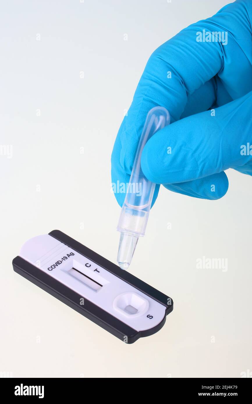Covid 19 PCR Rapid Test, Corona, la soluzione di prova viene fatta cadere nel campo campione Foto Stock