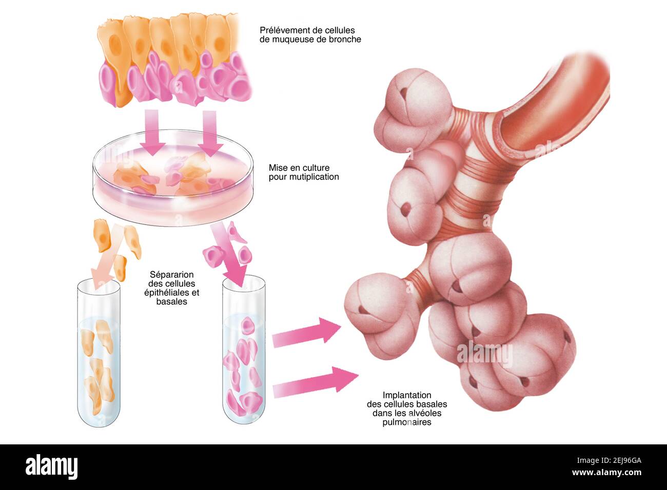 Terapia cellulare, illustrazione Foto Stock