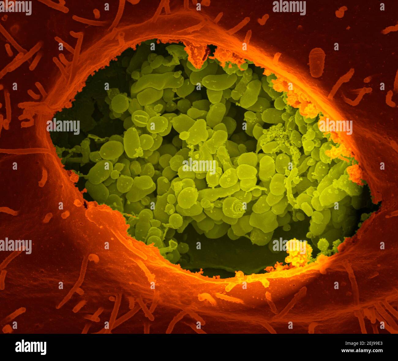 Coxiella burnetii, i batteri che causano la febbre q Foto Stock