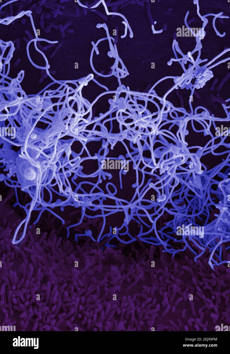 Virus Ebola da campione di sangue mali Foto Stock