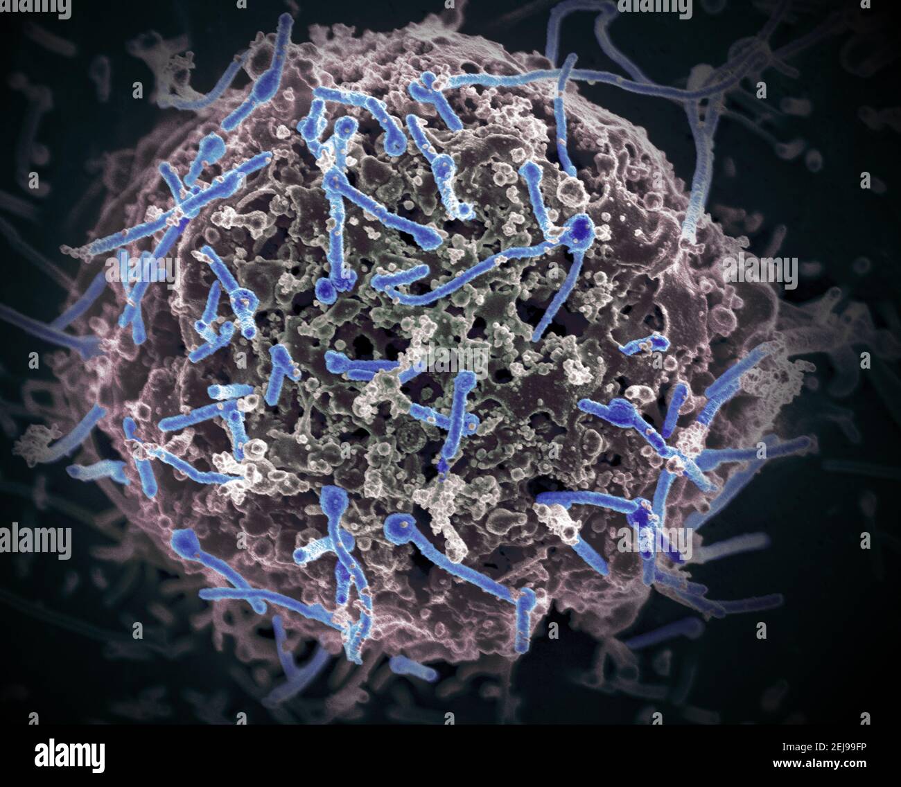 Virus Ebola da campione di sangue mali Foto Stock