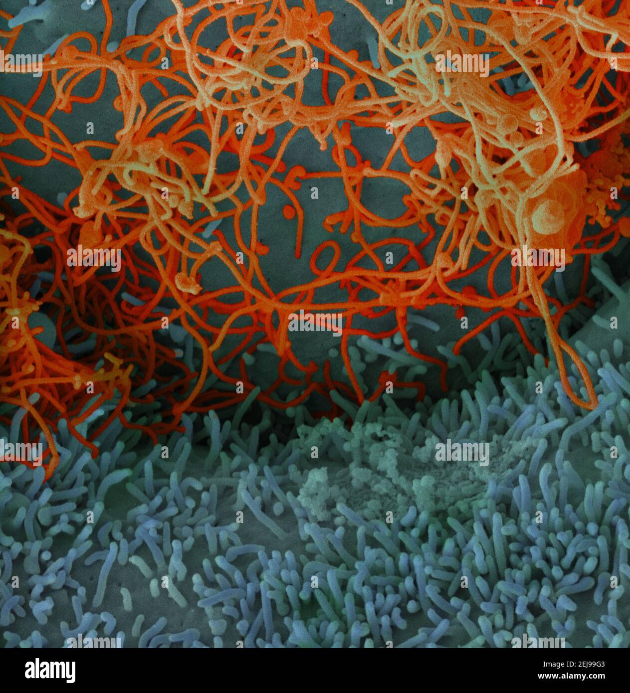 Virus Ebola da campione di sangue mali Foto Stock