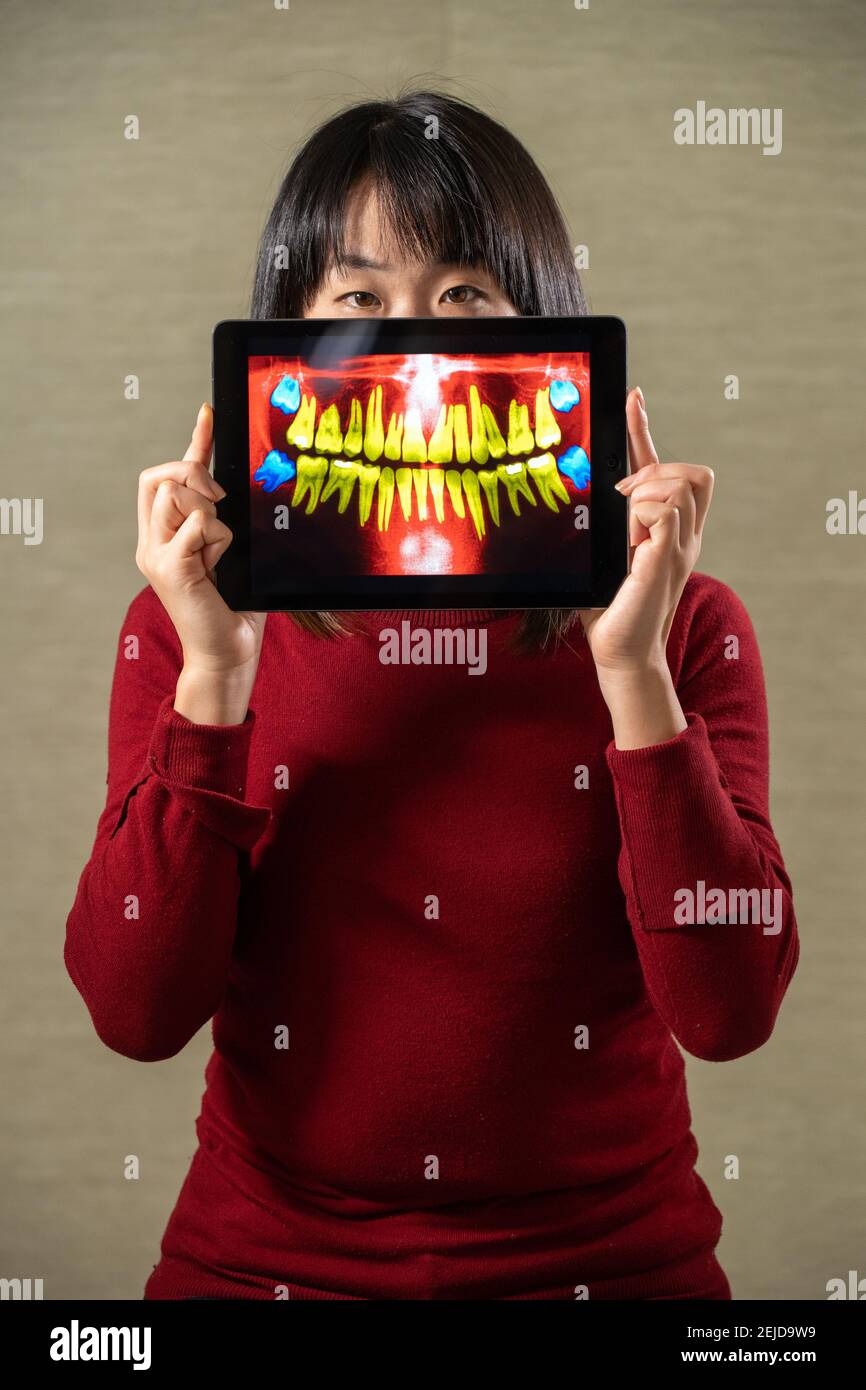 Donna che tiene lo schermo con l'immagine della dentizione dell'adulto Foto Stock