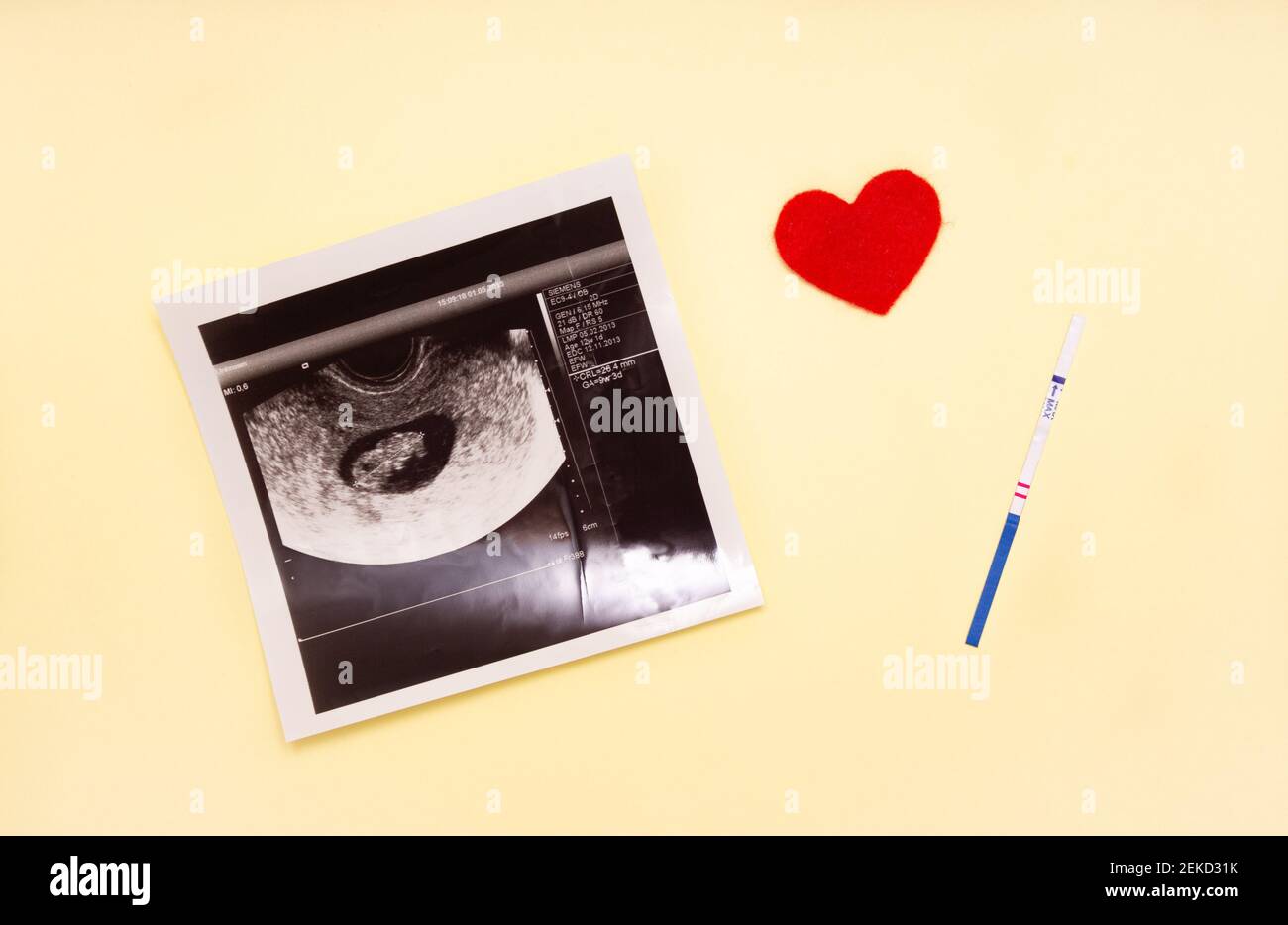 Tracciato del test di gravidanza positivo e immagine ecografica del feto, cuore rosso. Il concetto di concepimento, in attesa della nascita di un bambino, di una famiglia. Foto Stock