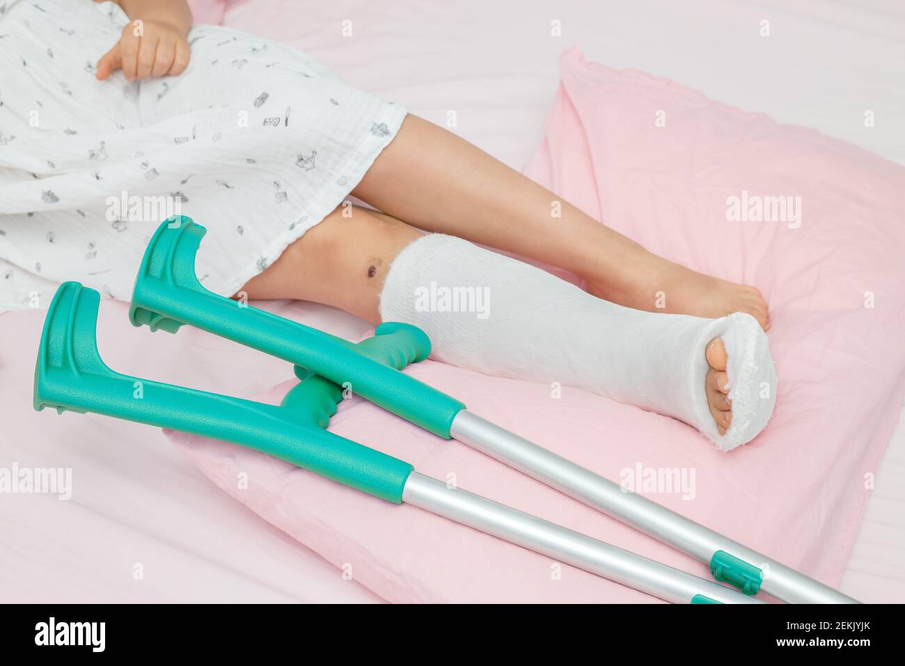 Fratture ossee sulla gamba di un bambino. Gamba per bambini in un getto sul  letto con stampelle nelle vicinanze Foto stock - Alamy