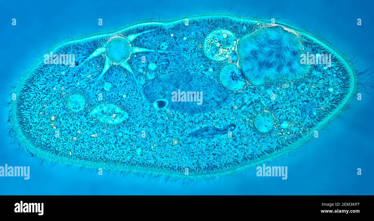 Animalcules Slipper (Paramecium caudium), immagine MRI a contrasto di fase, ingrandimento x120 correlato a 35mm, Germania Foto Stock