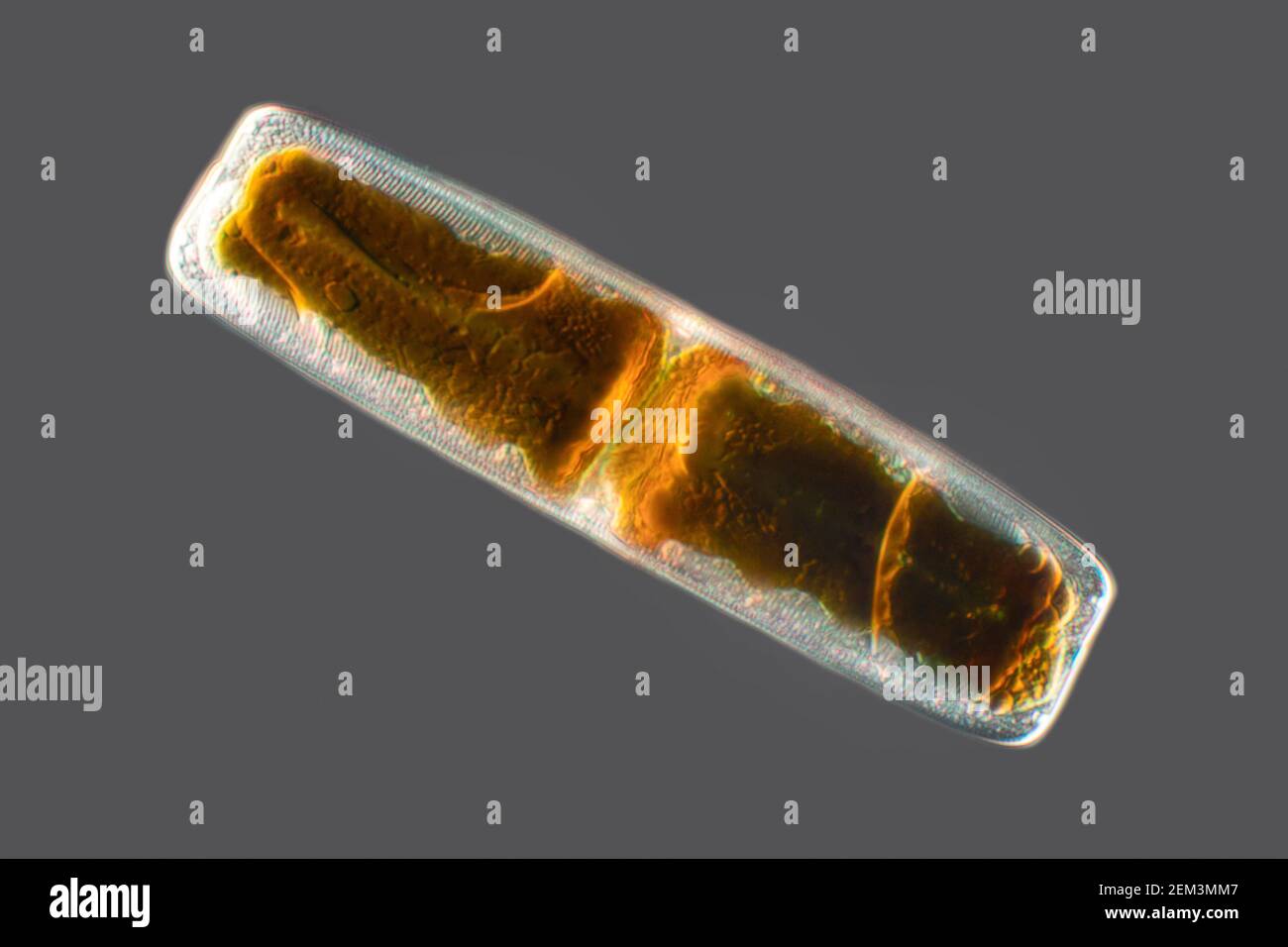 Diatomee (Diatomeae), diatomee dal Mar Mediterraneo, immagine di contrasto con interferenza differenziale, ingrandimento x200 relativo a 35 mm Foto Stock