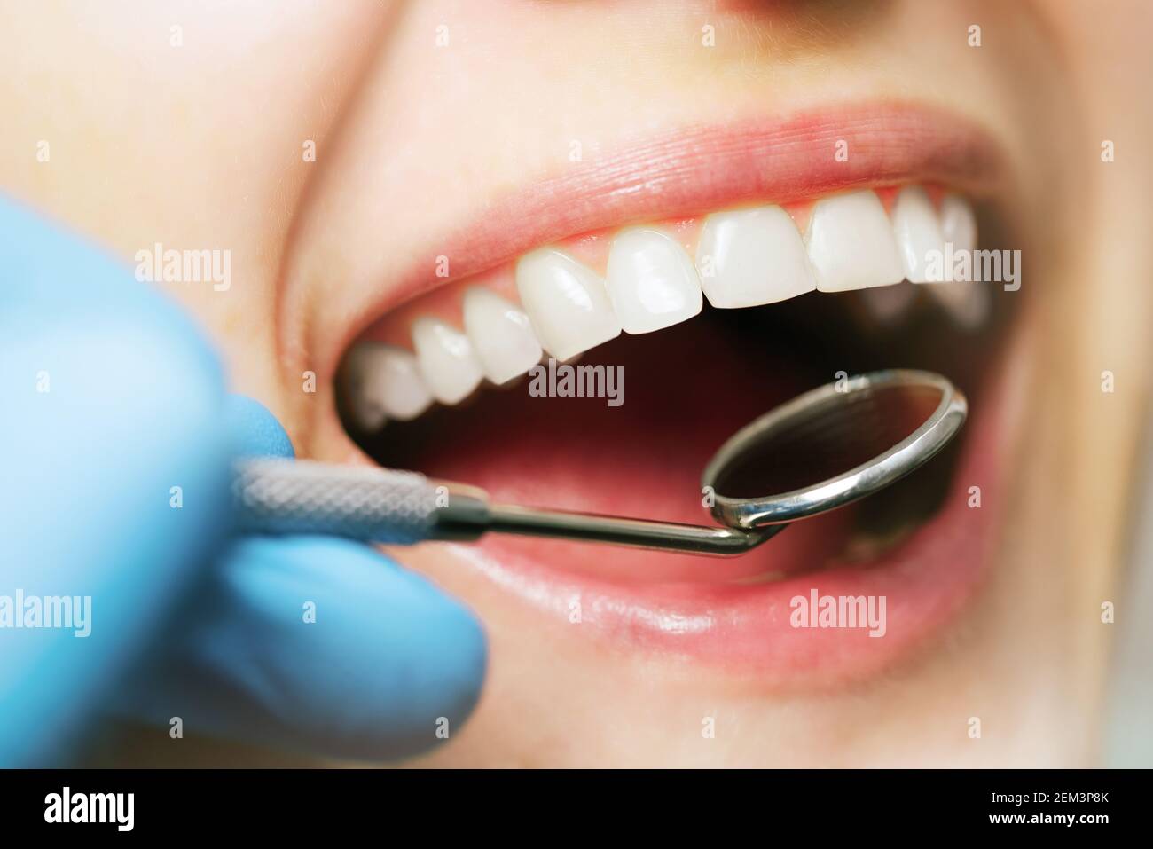 controllo della bocca igiene orale. denti sani della donna bianchi e specchio dentista. closeup Foto Stock