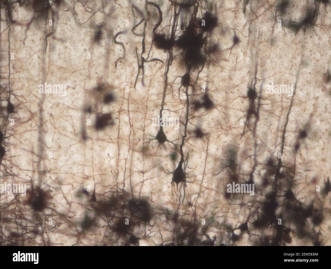 La sezione del cervello del topo si è macchiata con la macchia di Golgi, una tecnica del XIX secolo che è stata ampiamente utilizzata fino a poco tempo fa - e occasionalmente è ancora. Foto Stock