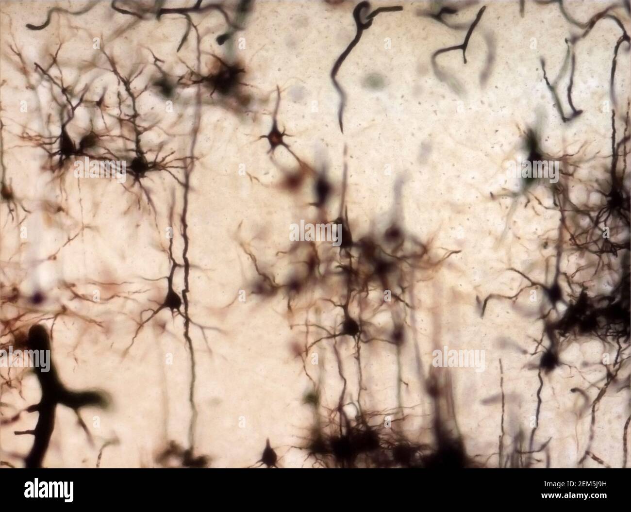 La sezione del cervello del topo si è macchiata con la macchia di Golgi, una tecnica del XIX secolo che è stata ampiamente utilizzata fino a poco tempo fa - e occasionalmente è ancora. Foto Stock