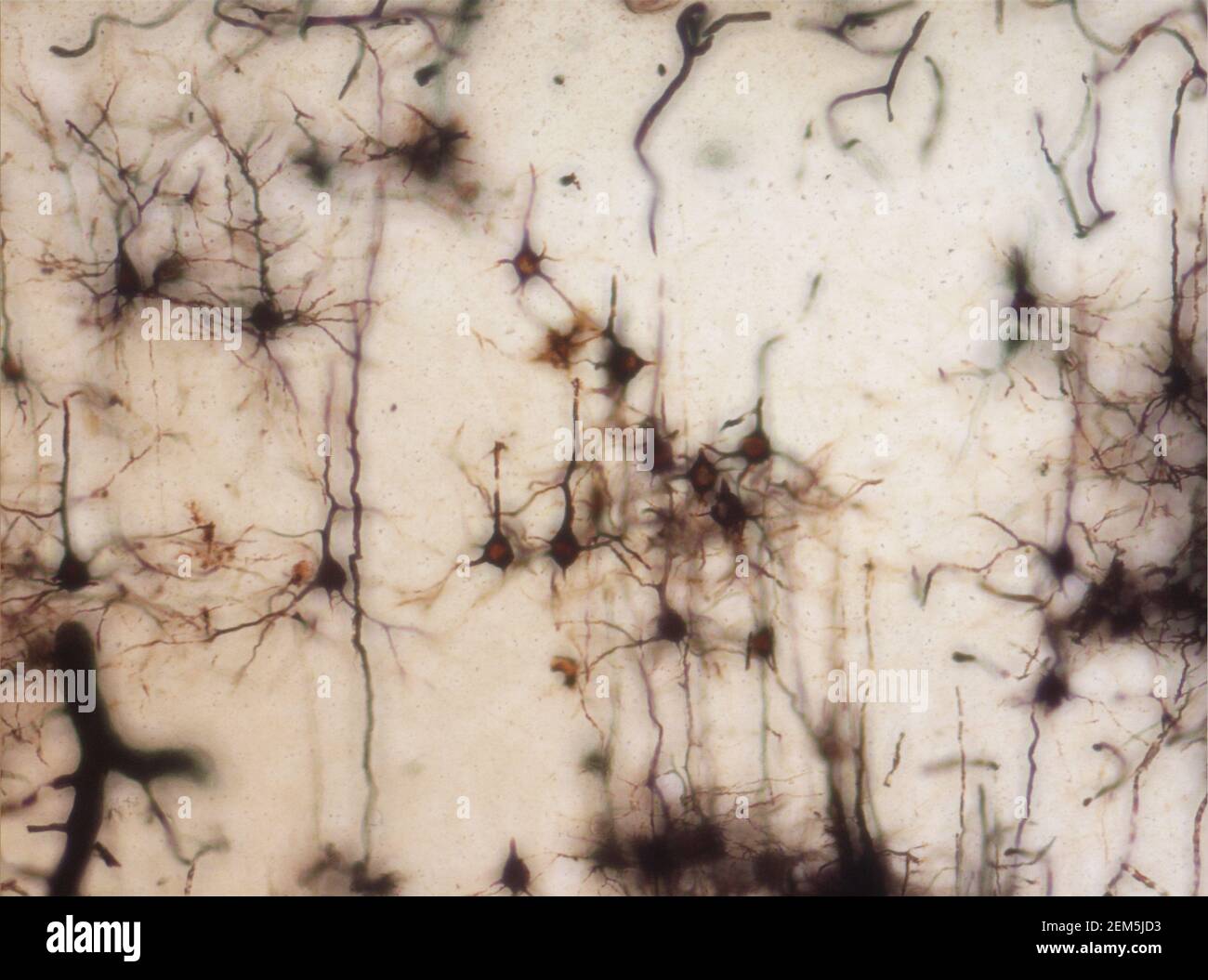 La sezione del cervello del topo si è macchiata con la macchia di Golgi, una tecnica del XIX secolo che è stata ampiamente utilizzata fino a poco tempo fa - e occasionalmente è ancora. Foto Stock