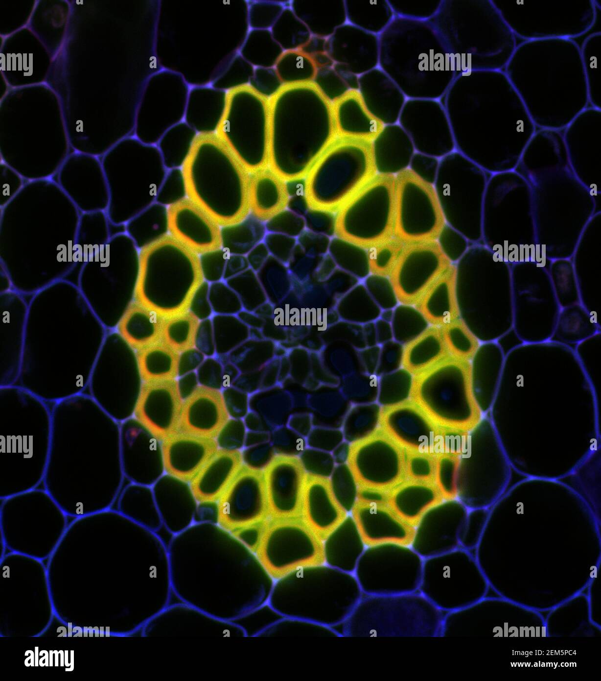Campione microscopico di pianta di Convallaria, segnale di fluorescenza osservato con microscopia a scansione laser confocale Foto Stock