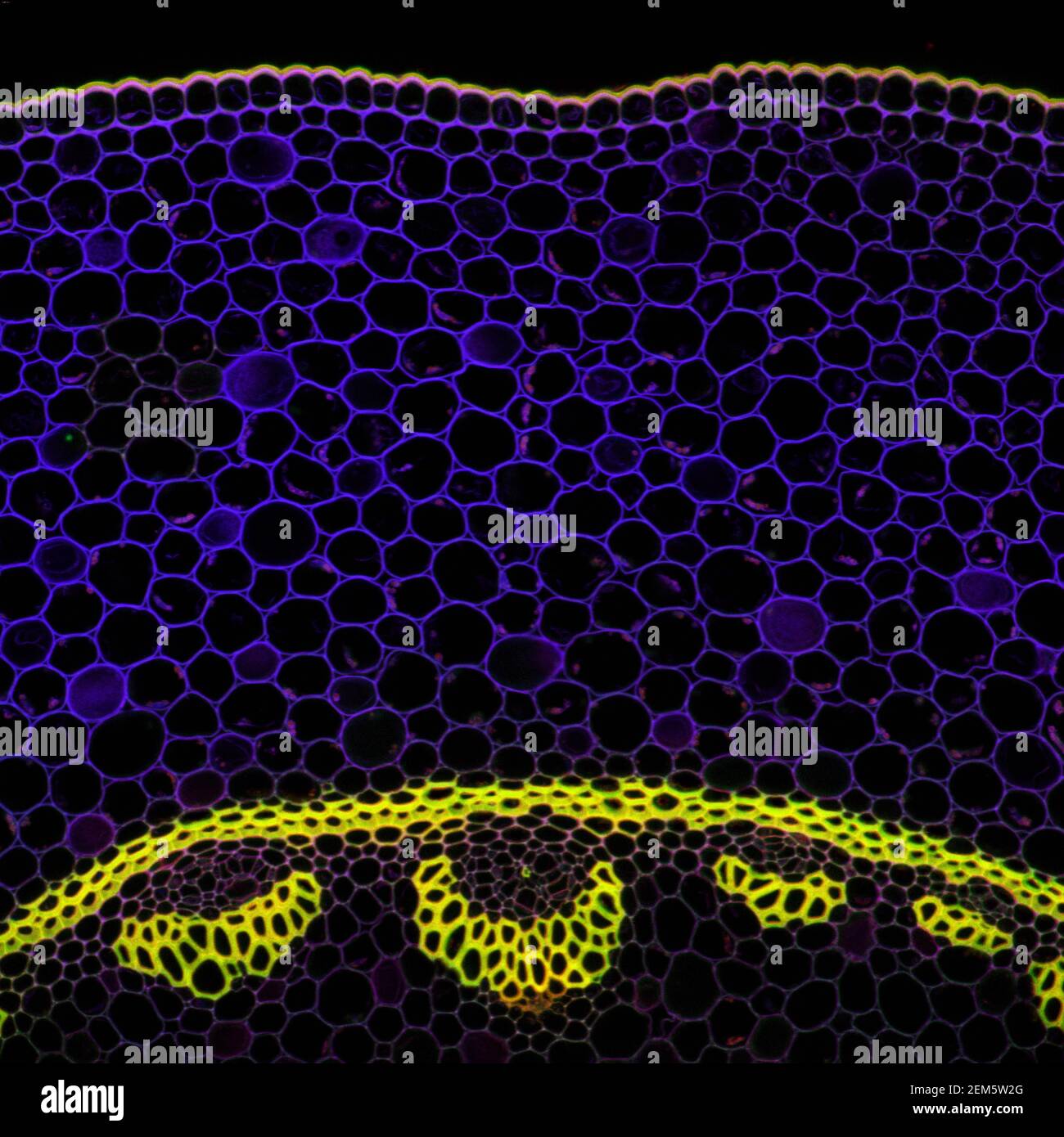 Campione microscopico di pianta di Convallaria, segnale di fluorescenza osservato con microscopia a scansione laser confocale Foto Stock