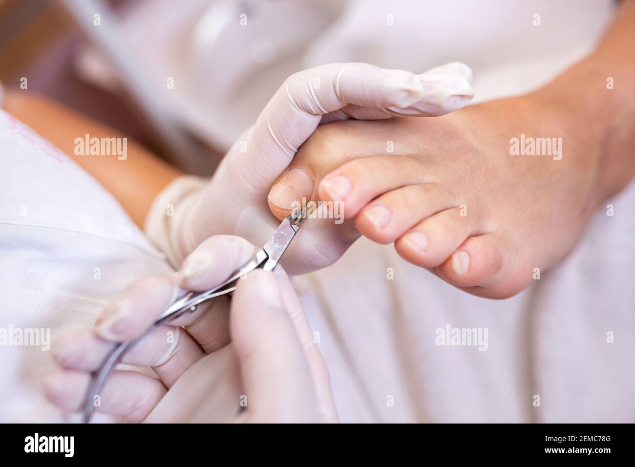 Taglio di chiodi, chiodi e cuticole sulle dita dei piedi con pinze Foto  stock - Alamy
