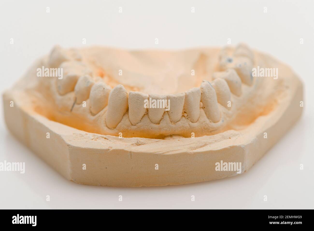 Insieme di immagini con un getto parziale di dentiera e dentiera che mostra i giochi dei denti mancanti su uno sfondo bianco con il riflesso. Foto Stock