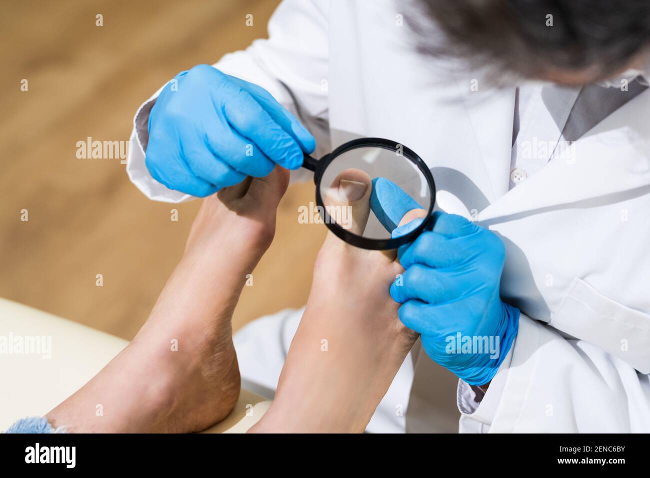 Problema di coda di rondine. Controllo del piede del paziente infetto Foto Stock