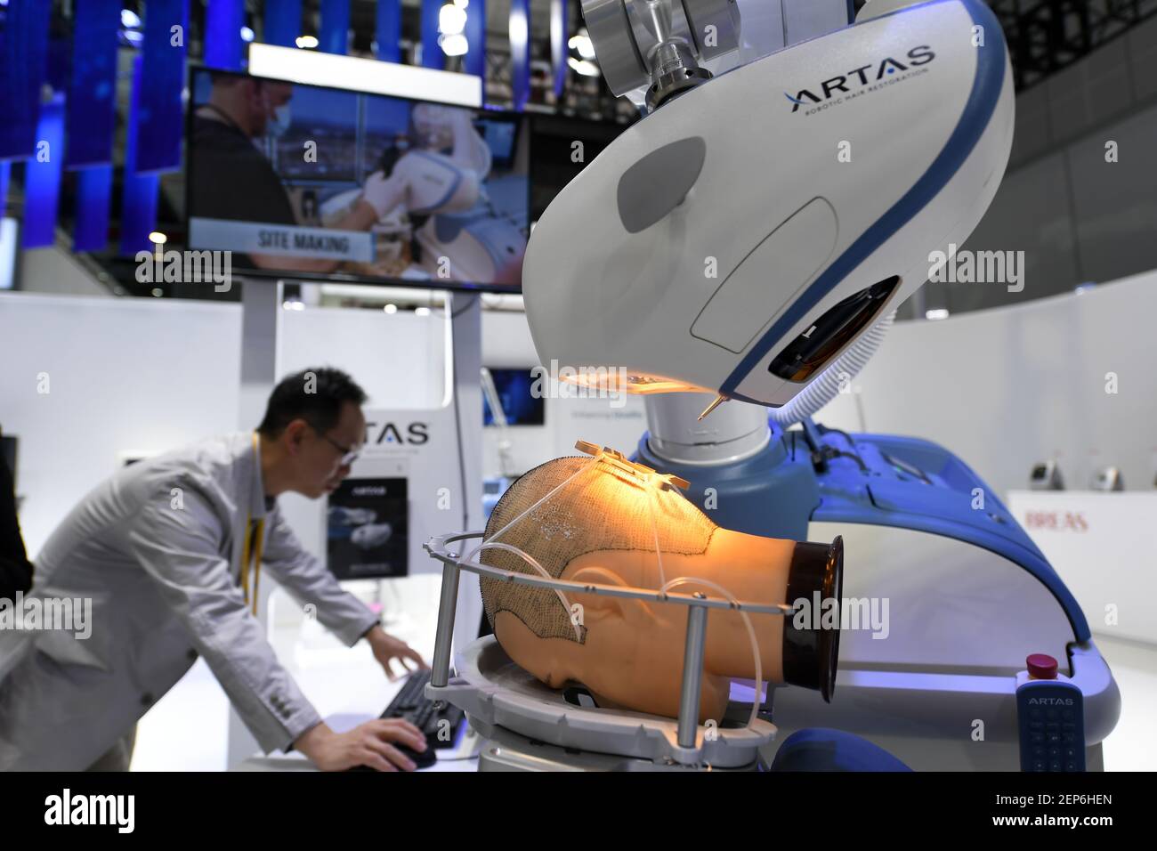 Un trapianto di capelli robot non i capelli chirurgia dei trapianti su un  modello al 2 ° China International Import Expo (CIIE) in Cina a Shanghai, 5  novembre 2019 Foto stock - Alamy