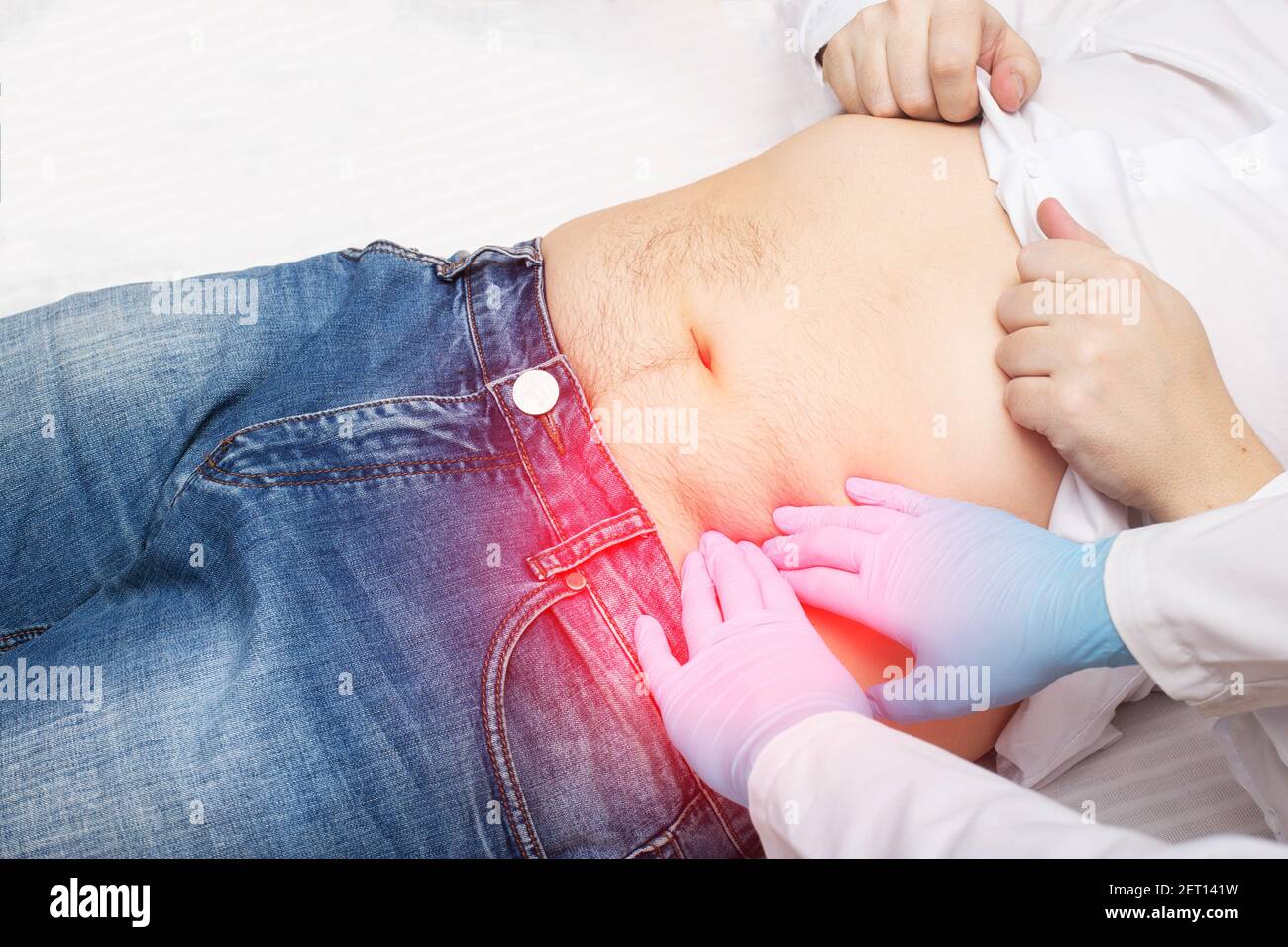 Il medico, con l'aiuto della palpazione, esamina l'addome del paziente che ha dolore e rombo. Concetto di malattia intestinale, sigmoidite. Intestinale Foto Stock