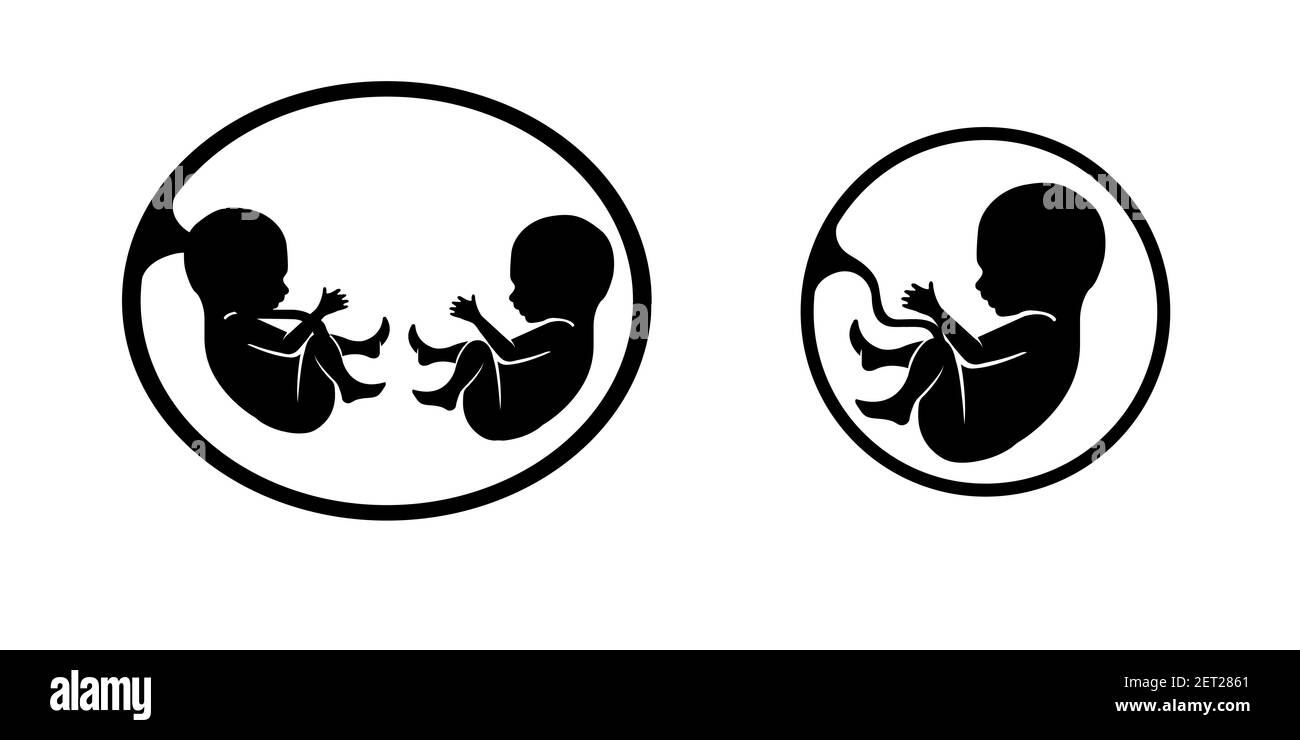 Scansione a ultrasuoni del bambino. Foto di una donna incinta a scansione. Illustrazione Vettoriale