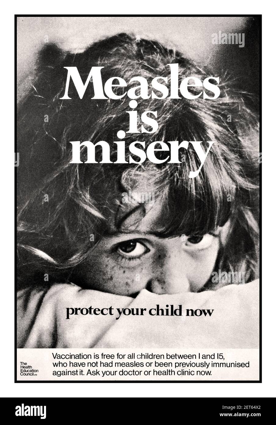Vintage 1970's UK vaccination public Health poster 'Measels is Misery - Protect Your Child Now' pubblicato dal British Health Education Council - bambino giovane alla ricerca 'la vaccinazione è gratuita per tutti i bambini tra 1 e 15 anni, che non hanno avuto misurini o sono stati precedentemente immunizzati contro di esso. Chieda ora al vostro medico o alla clinica di salute. Regno Unito 1970 vaccinazione Jab vaccino protezione Foto Stock
