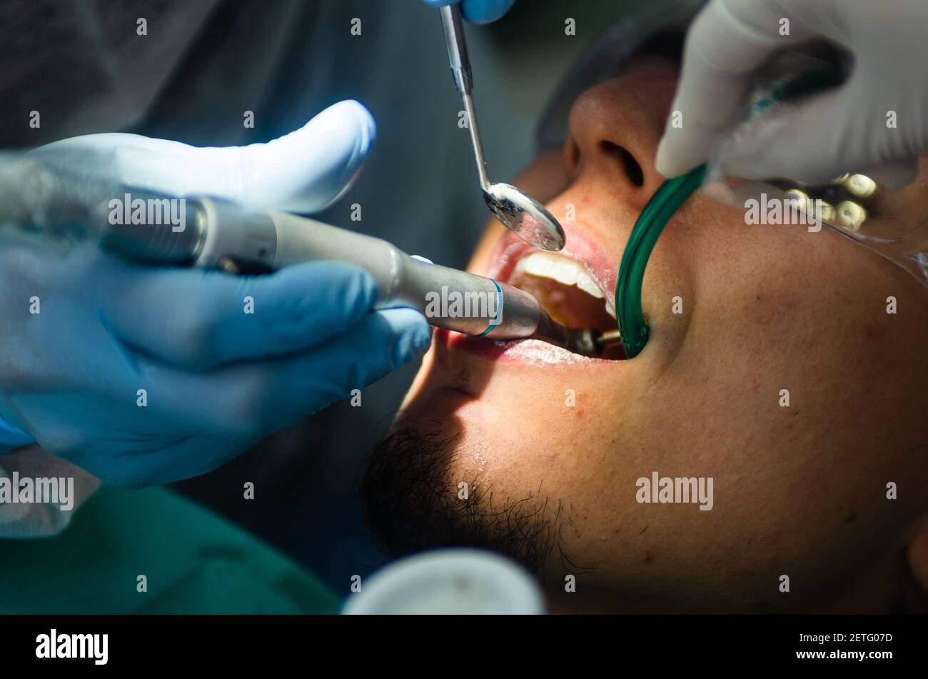 Un giovane paziente di sesso maschile prende una presenza dentale nell'ufficio del dentista. Foto Stock