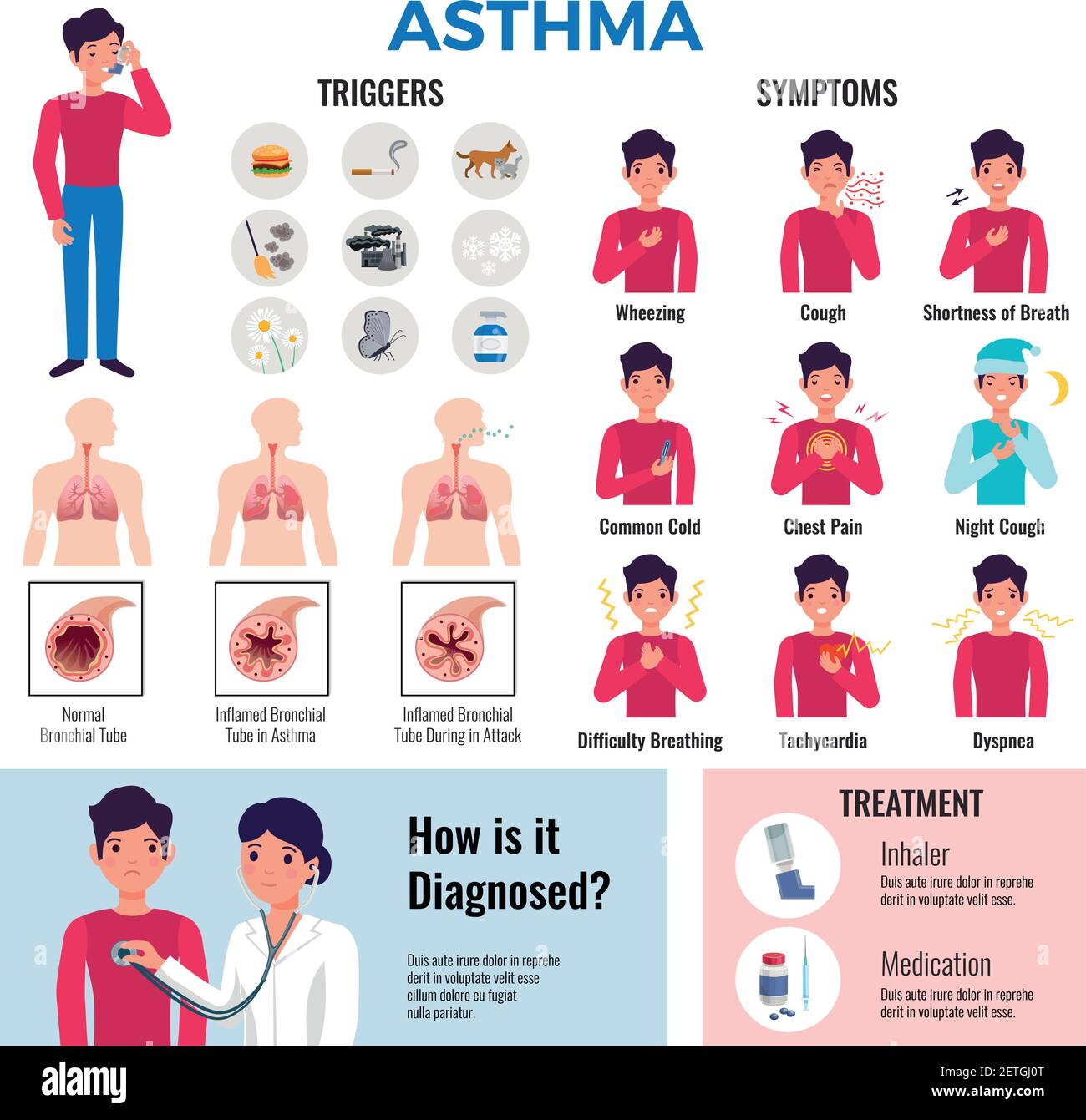 Asma malattia cronica raccolta di elementi infografici piatti con sintomi trigger causa la diagnosi del farmaco e l'illustrazione del vettore di trattamento Illustrazione Vettoriale