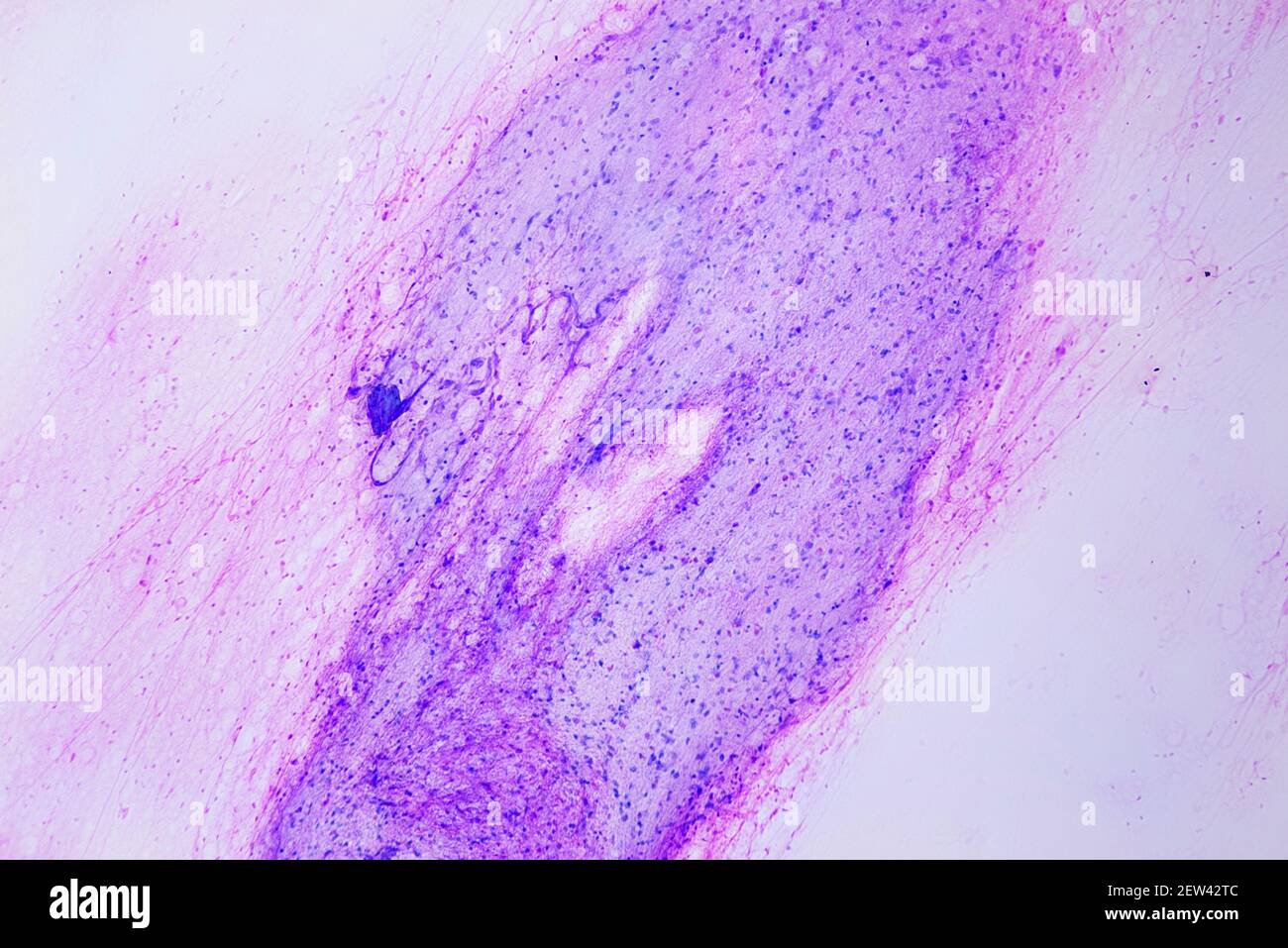 Cellule nervose isolate in uno striscio del midollo spinale attraverso un microscopio a luce (ingrandimento 10 x) Foto Stock