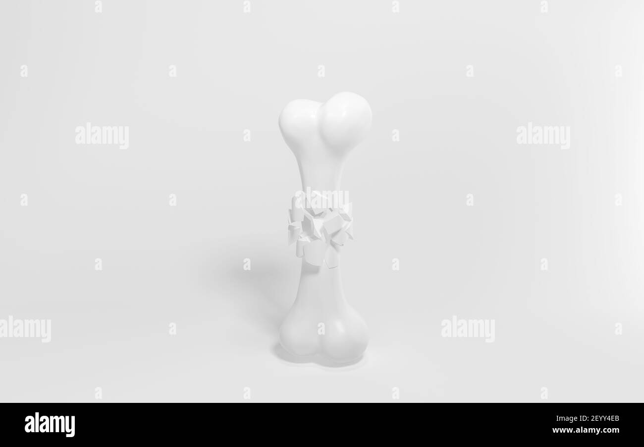 Crack Bone isolato su sfondo bianco, rendering 3d. Disegno digitale per computer. Foto Stock