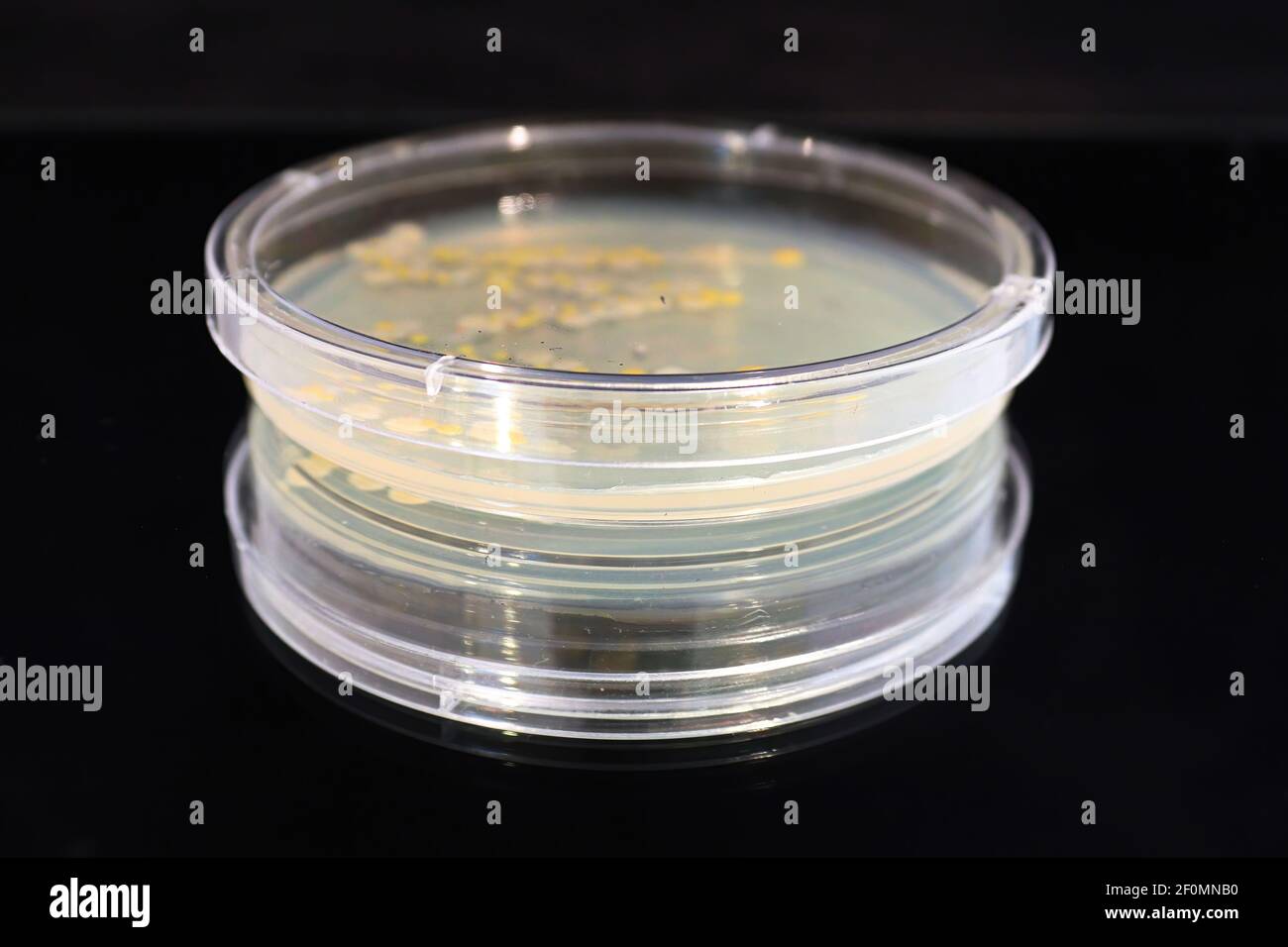 Una capsula di Petri con colonie comuni di lievito e batteri Foto Stock