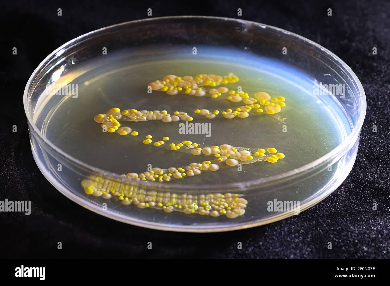 Una capsula di Petri con colonie comuni di lievito e batteri Foto Stock