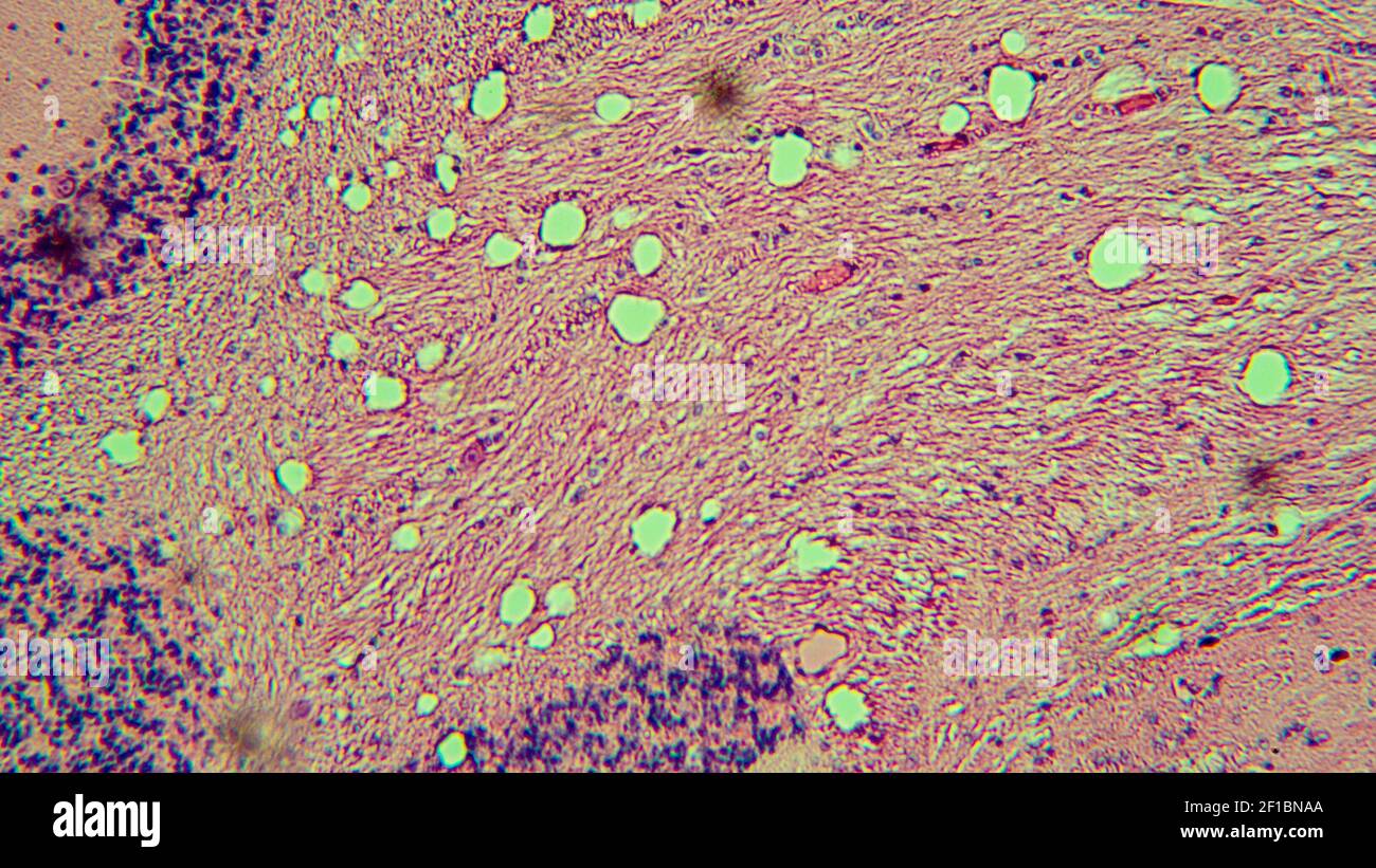 Immagini di cellule biologiche al microscopio Foto Stock