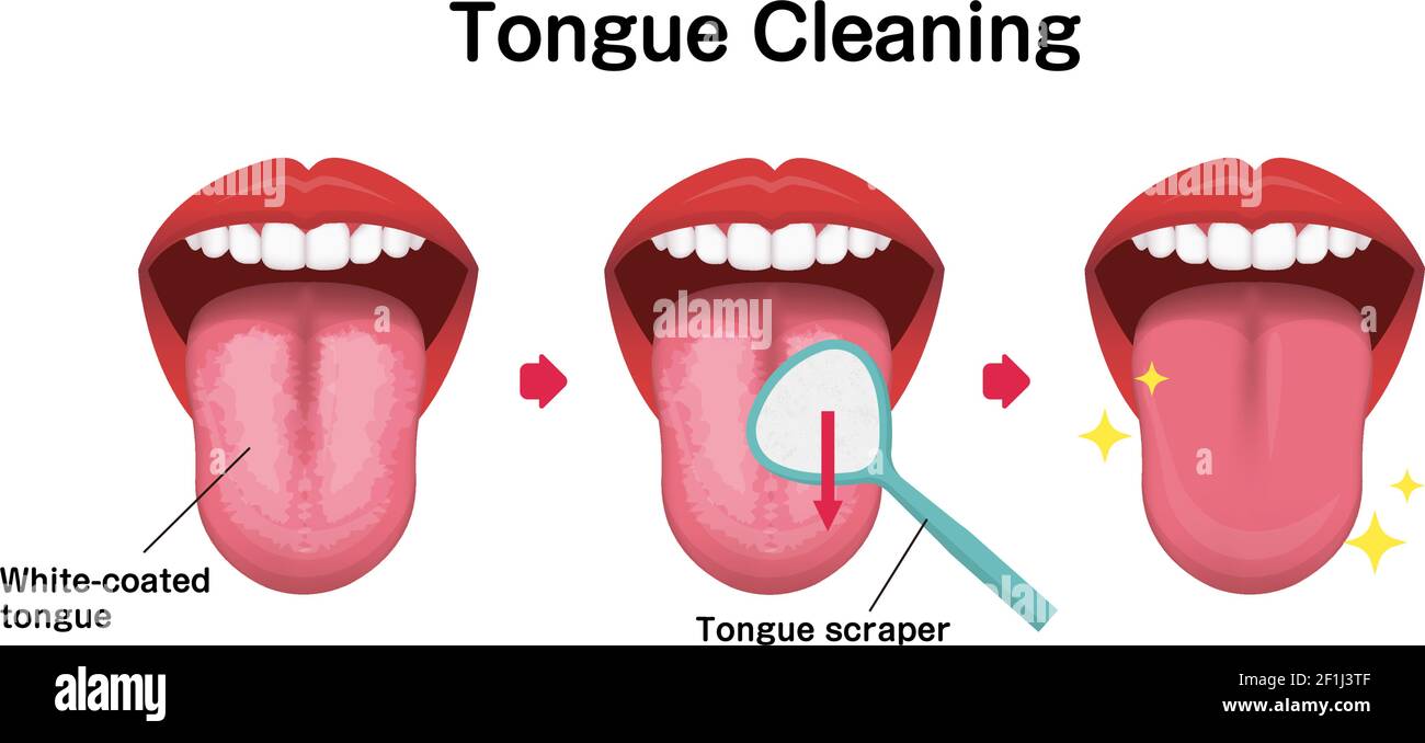 Come pulire l'illustrazione del vettore della lingua (prevenzione dell' alitosi Immagine e Vettoriale - Alamy
