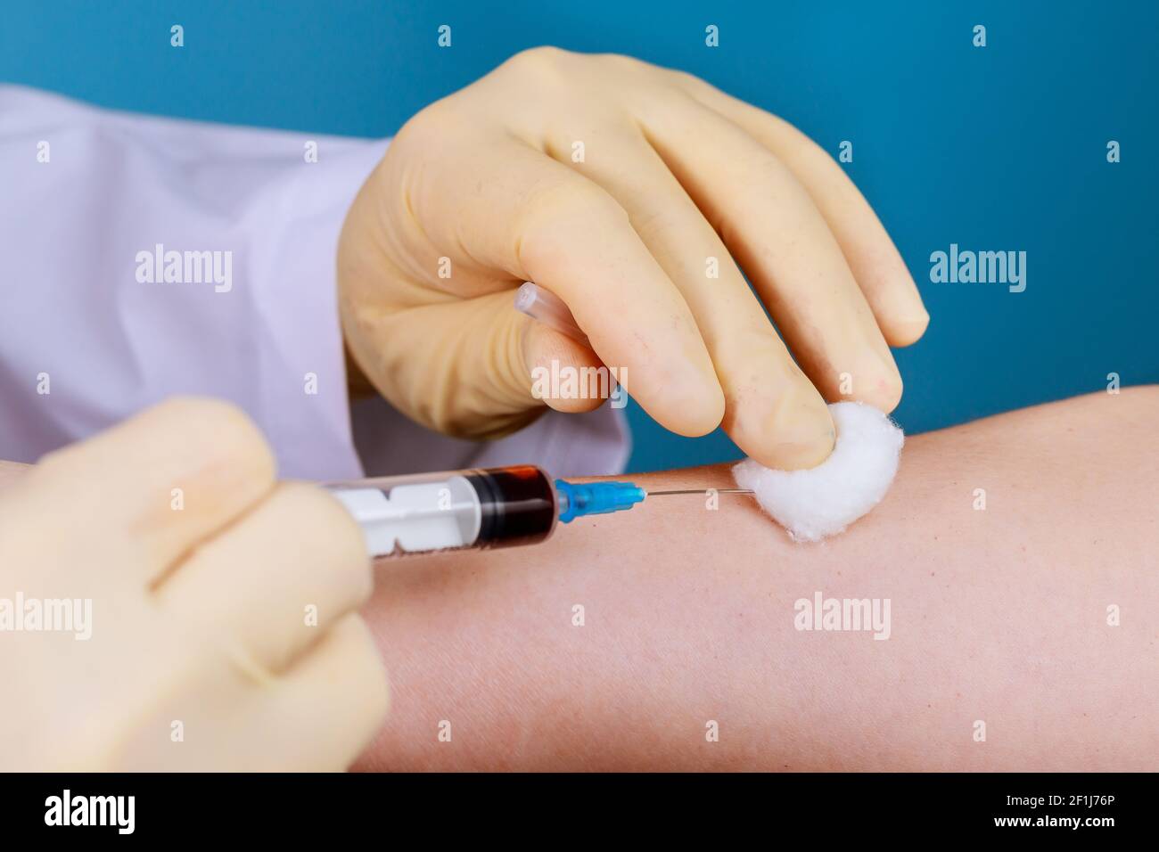 Un infermiere usa una siringa per prelevare un campione di sangue Da un  uomo da testare per l'HIV AIDS Foto stock - Alamy