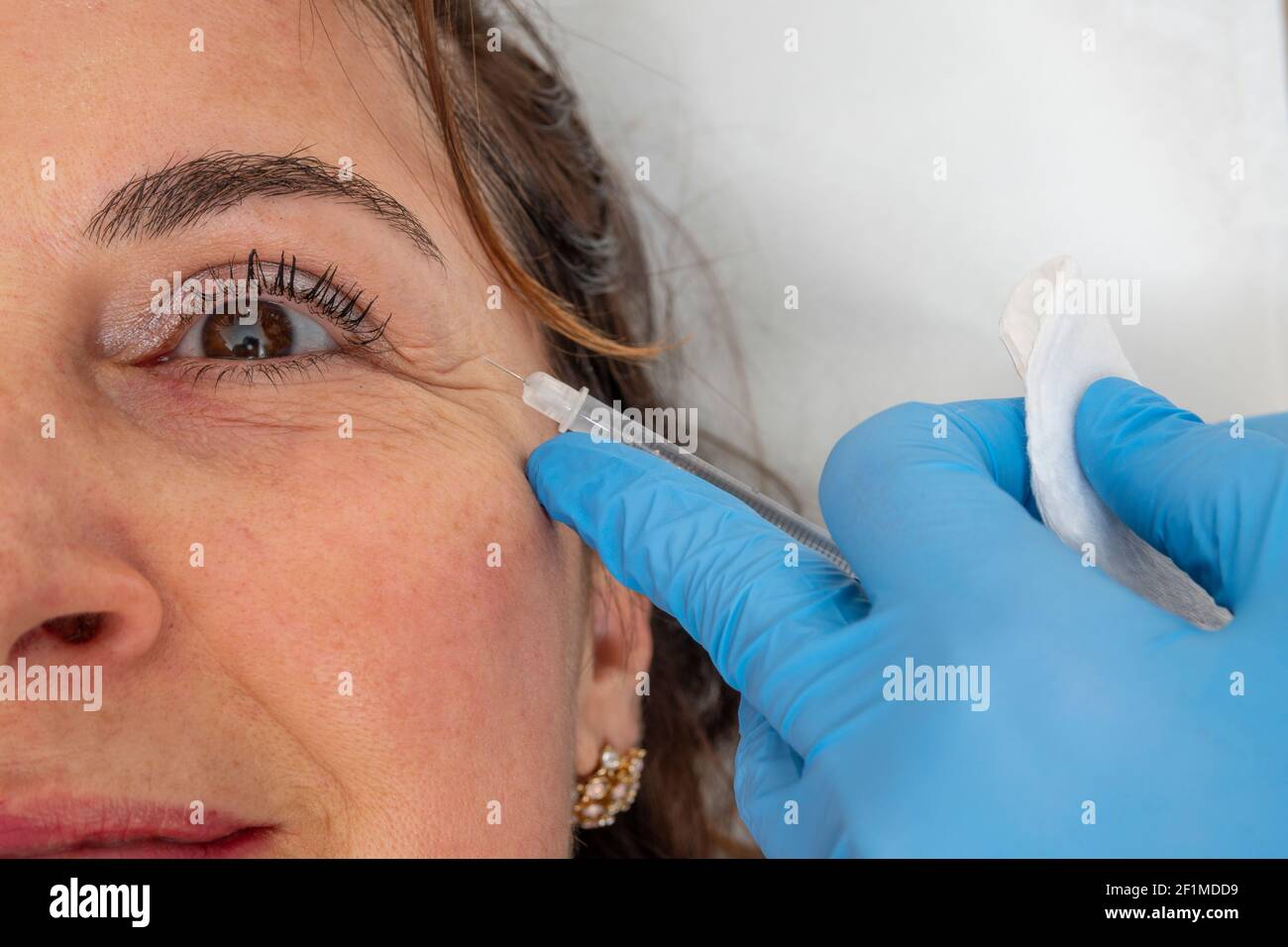 Concetto di trattamento viso anti invecchiamento e ringiovanente: L'esperto dermatologico inietta un trattamento liquido anti rughe. Cura professionale a donna di mezza età. Foto Stock