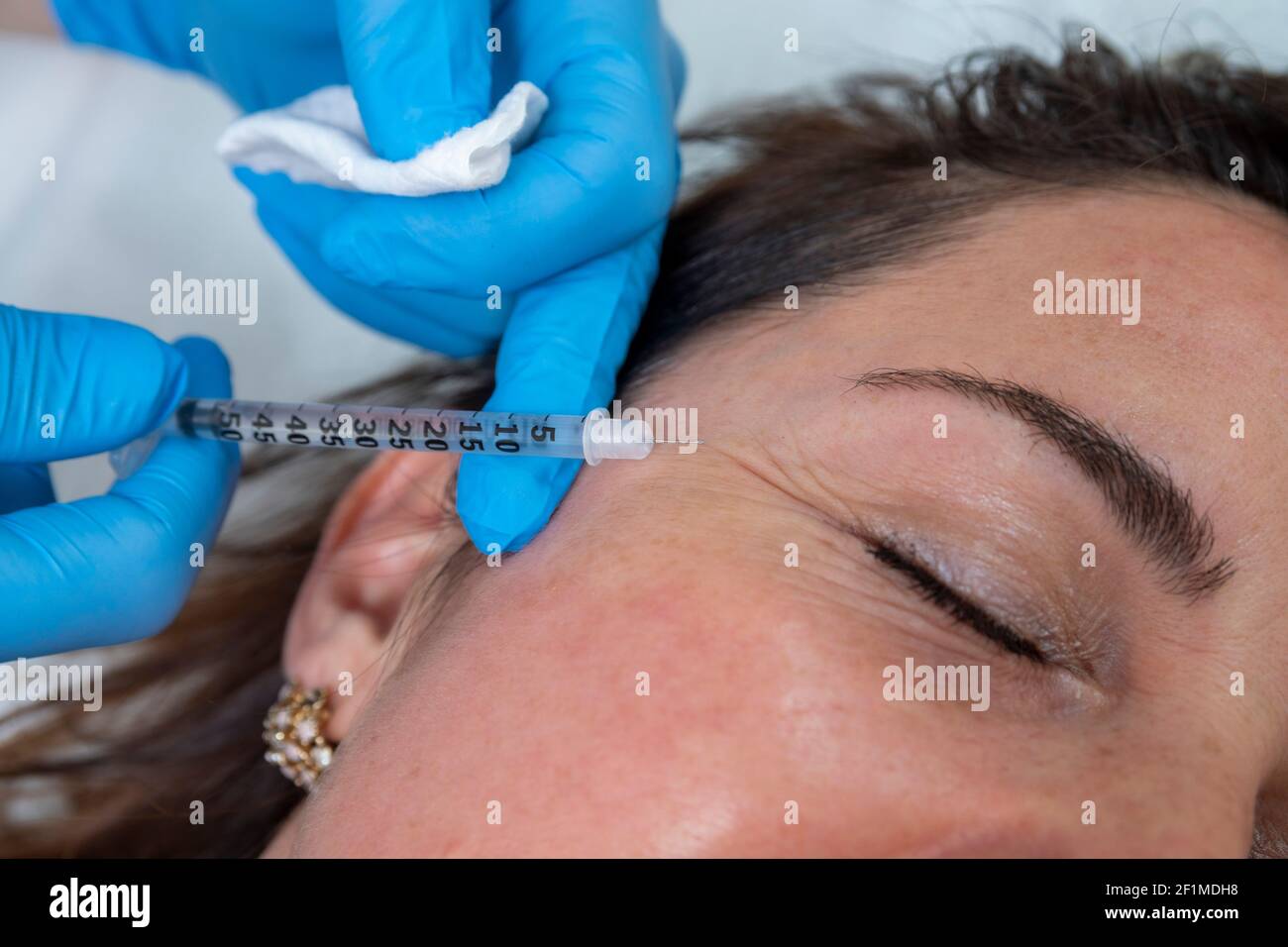 Concetto di trattamento viso anti invecchiamento e ringiovanente: L'esperto dermatologico inietta un trattamento liquido anti rughe. Cura professionale a donna di mezza età. Foto Stock