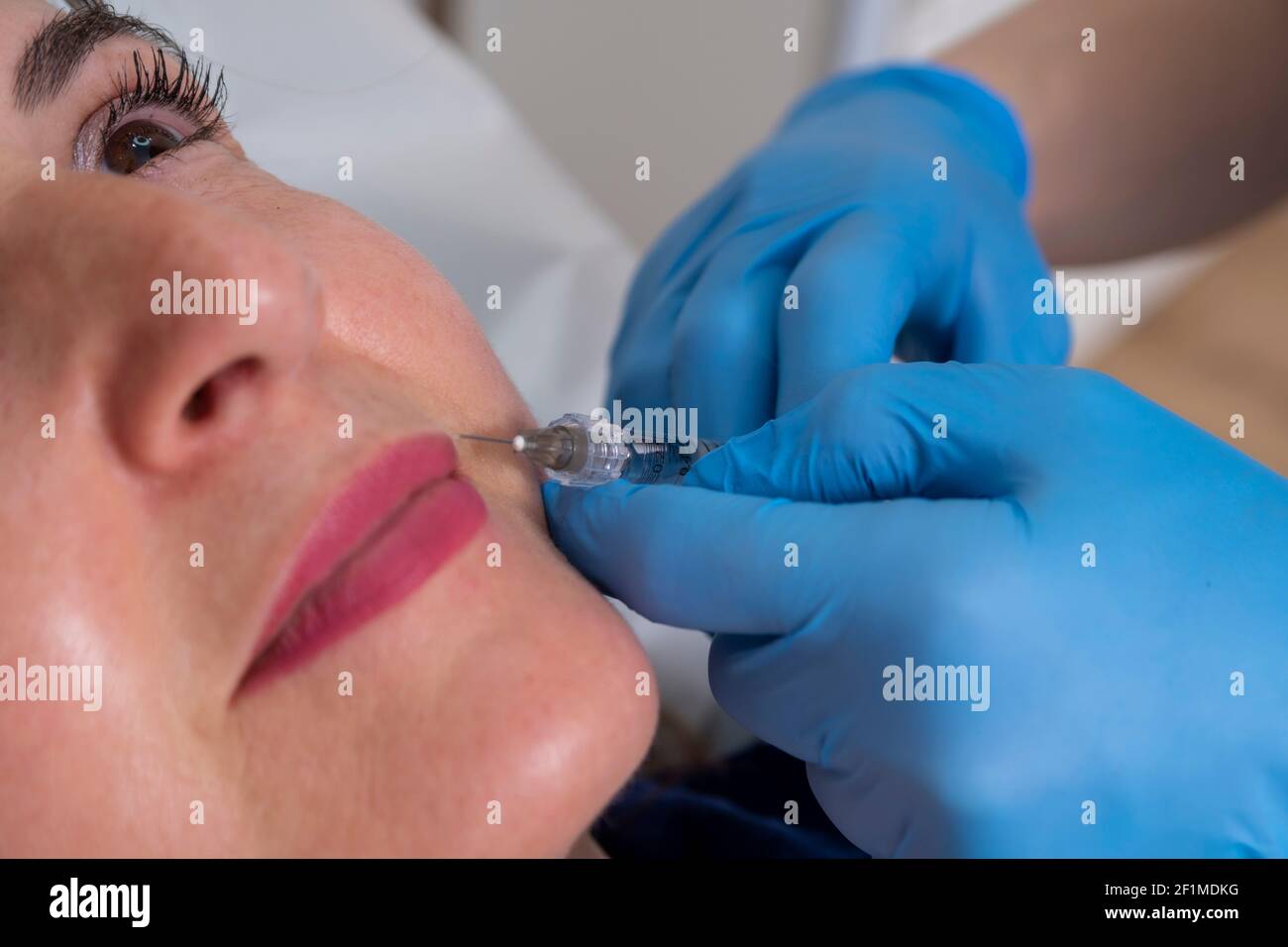 Concetto di trattamento viso anti invecchiamento e ringiovanente: L'esperto dermatologico inietta un trattamento liquido anti rughe. Cura professionale a donna di mezza età. Foto Stock