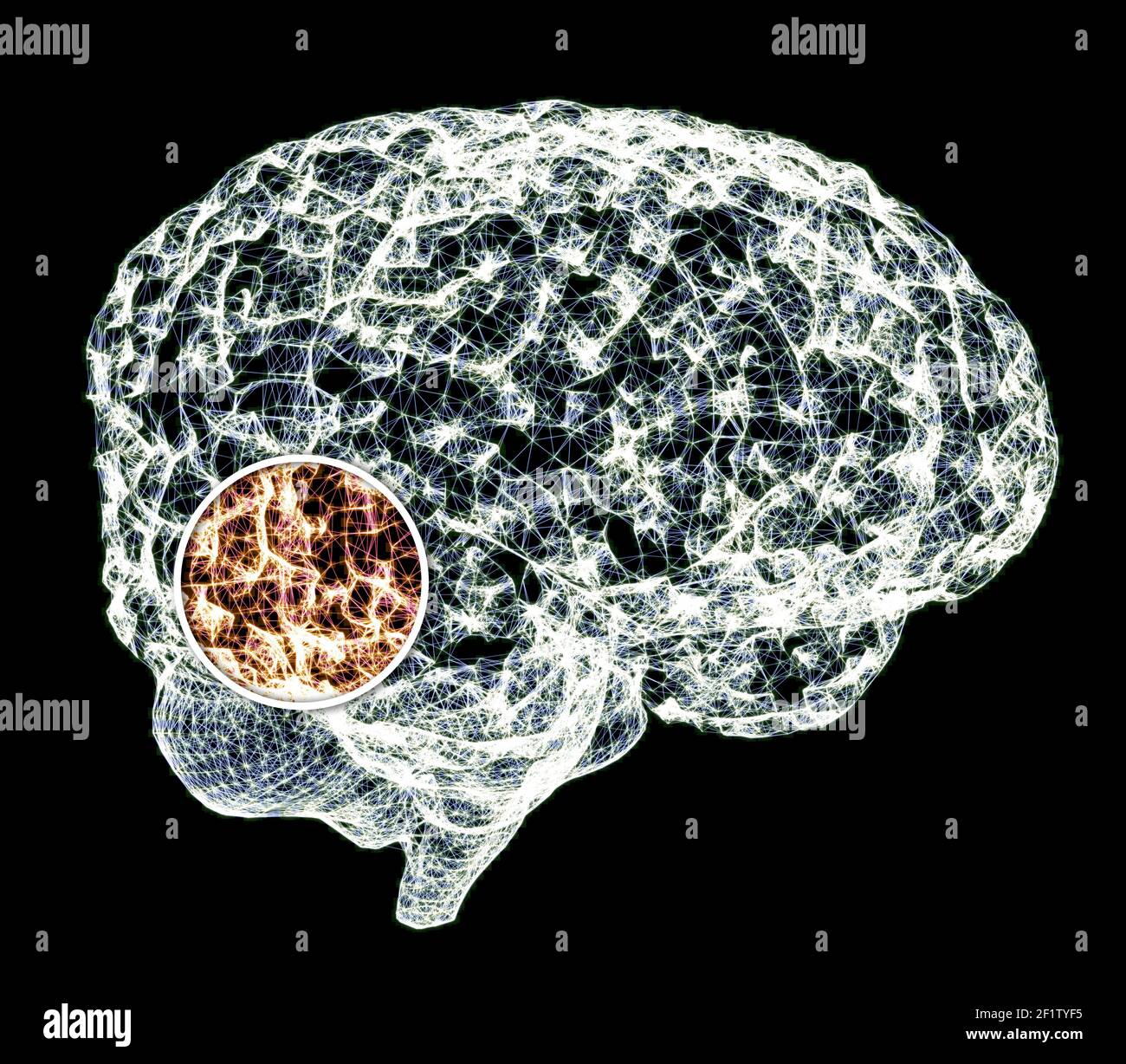 Dolore alla testa, al cervello e alle sinapsi, problemi cognitivi, deficit mentale. Aneurisma. Malattie degenerative che interessano l'area del cervello. Parkinson, ictus Foto Stock