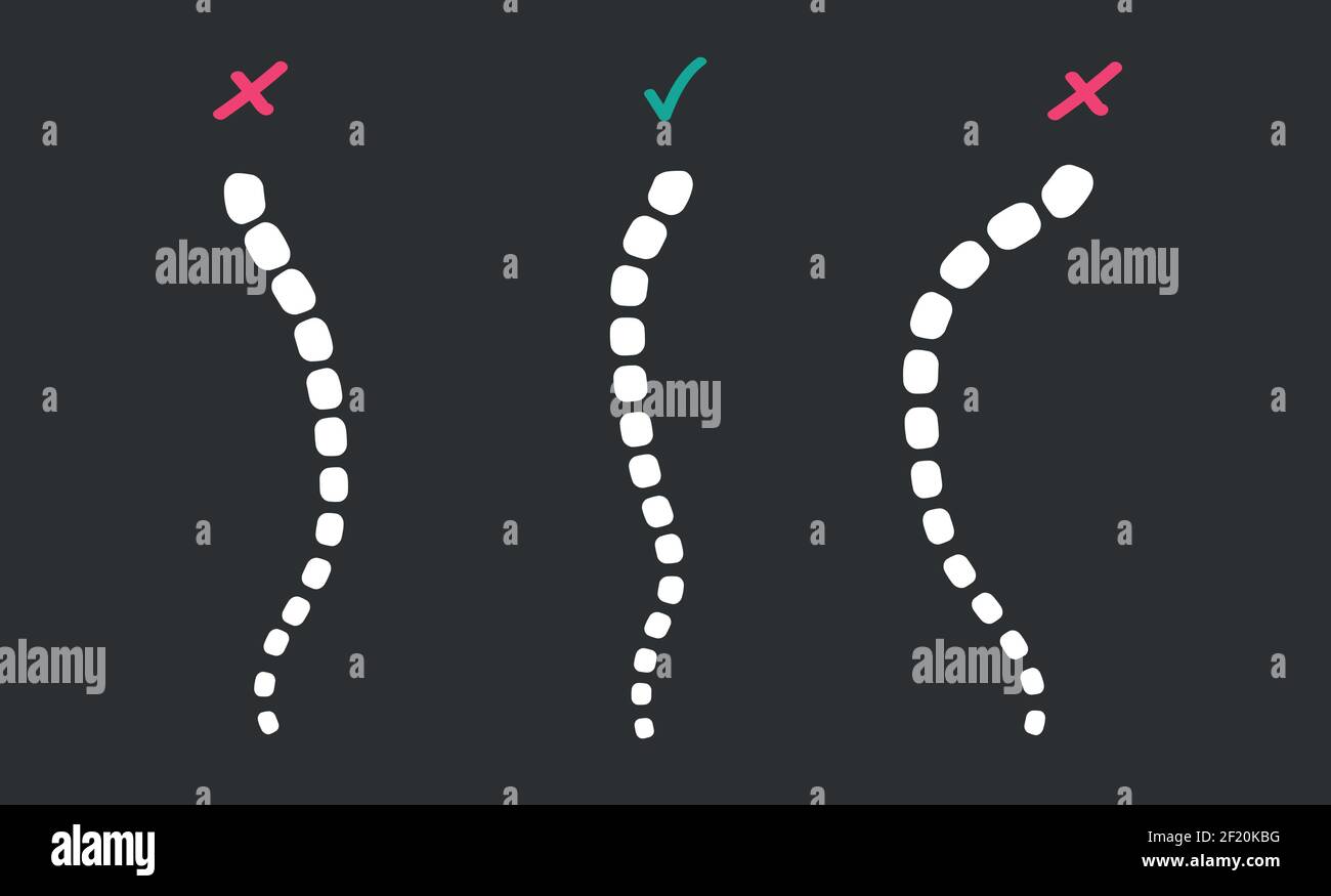 Tre spine sullo schermo. Illustrazione vettoriale medico studiando problemi colonna paziente. Illustrazione Vettoriale