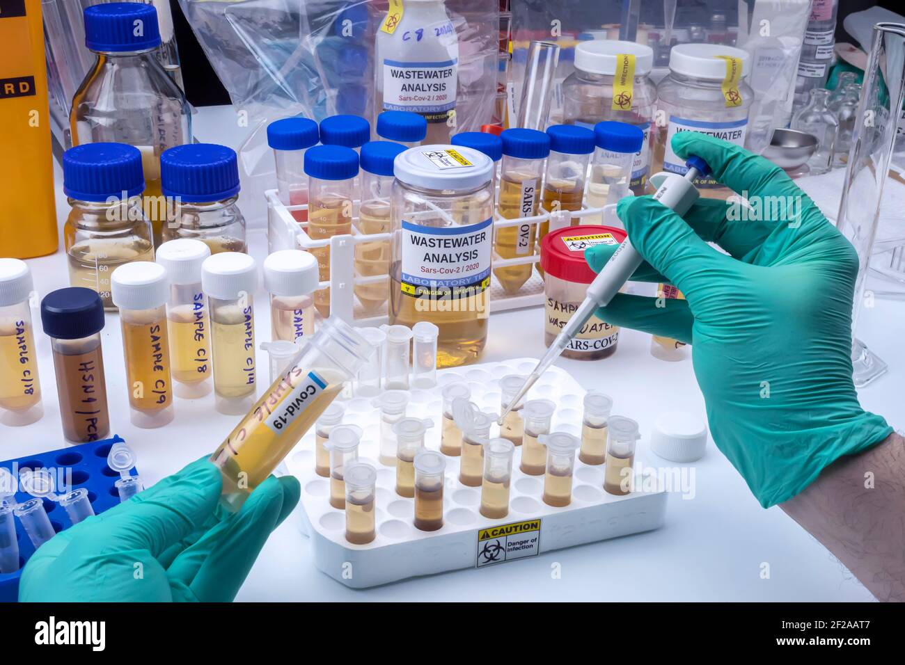 Analisi del virus sars-COV-2 nell'uomo in un laboratorio di acque reflue, immagine concettuale Foto Stock