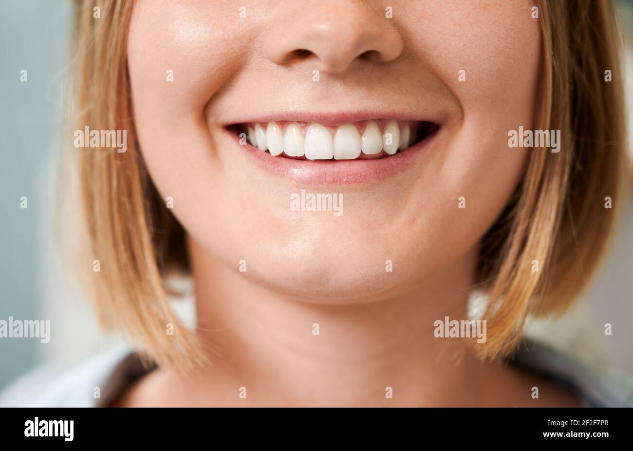 Un'istantanea ritagliata di un bel sorriso femminile che dimostra denti perfetti. Foto Stock