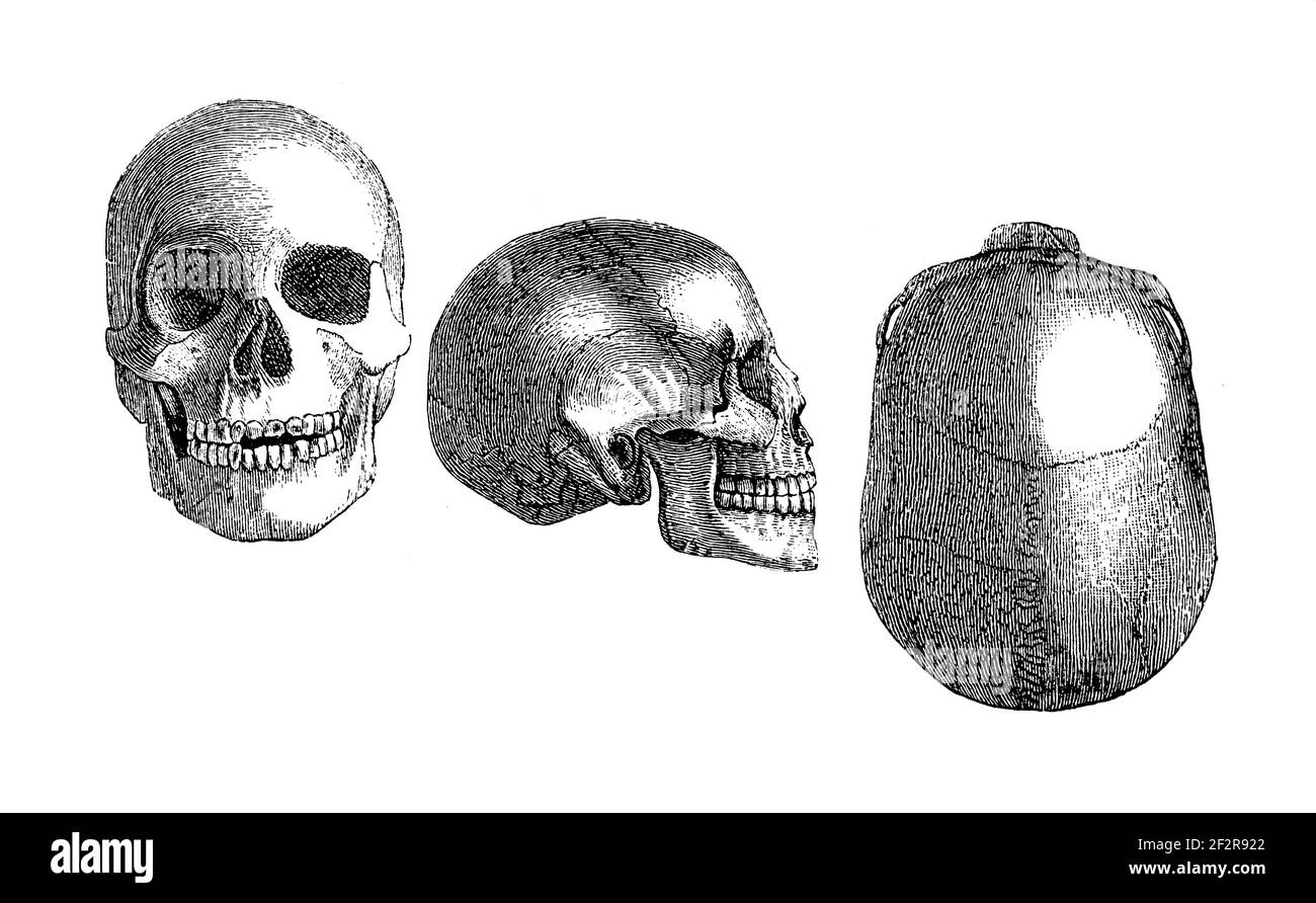 Illustrazione del XIX secolo dei teschi egiziani. Incisione pubblicata su Systematischer Bilder-Atlas zum Conversations-Lexikon, Ikonographische Encyklopae Foto Stock