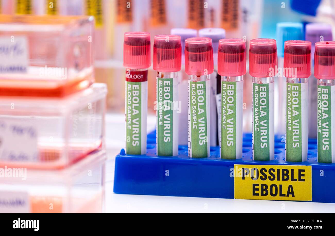 Fiale campione di sangue da possibili pazienti Ebola infettati con nuovo ceppo Zaire di Ebola, immagine concettuale Foto Stock