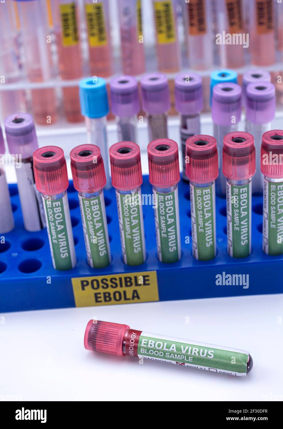 Fiale campione di sangue da possibili pazienti Ebola infettati con nuovo ceppo Zaire di Ebola, immagine concettuale Foto Stock