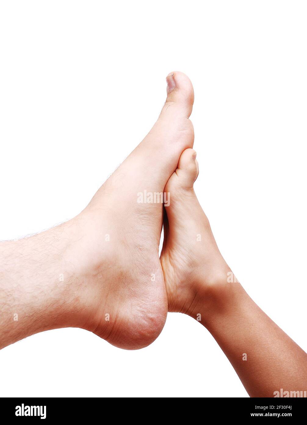Un piede grande e un altro piccolo Foto Stock
