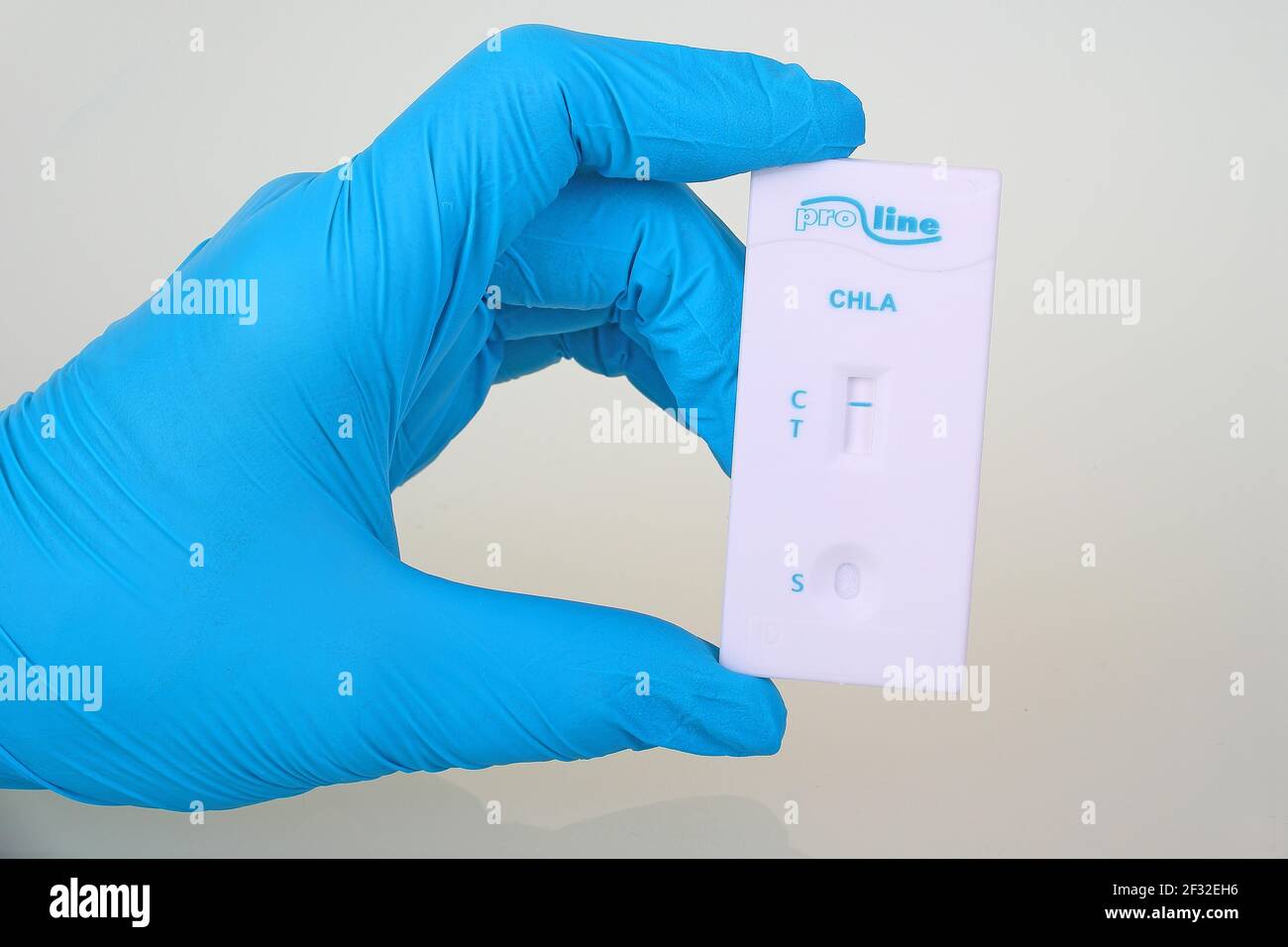 Test rapido Chlamydia da prolina, striscia di controllo visibile, risultato test negativo Foto Stock