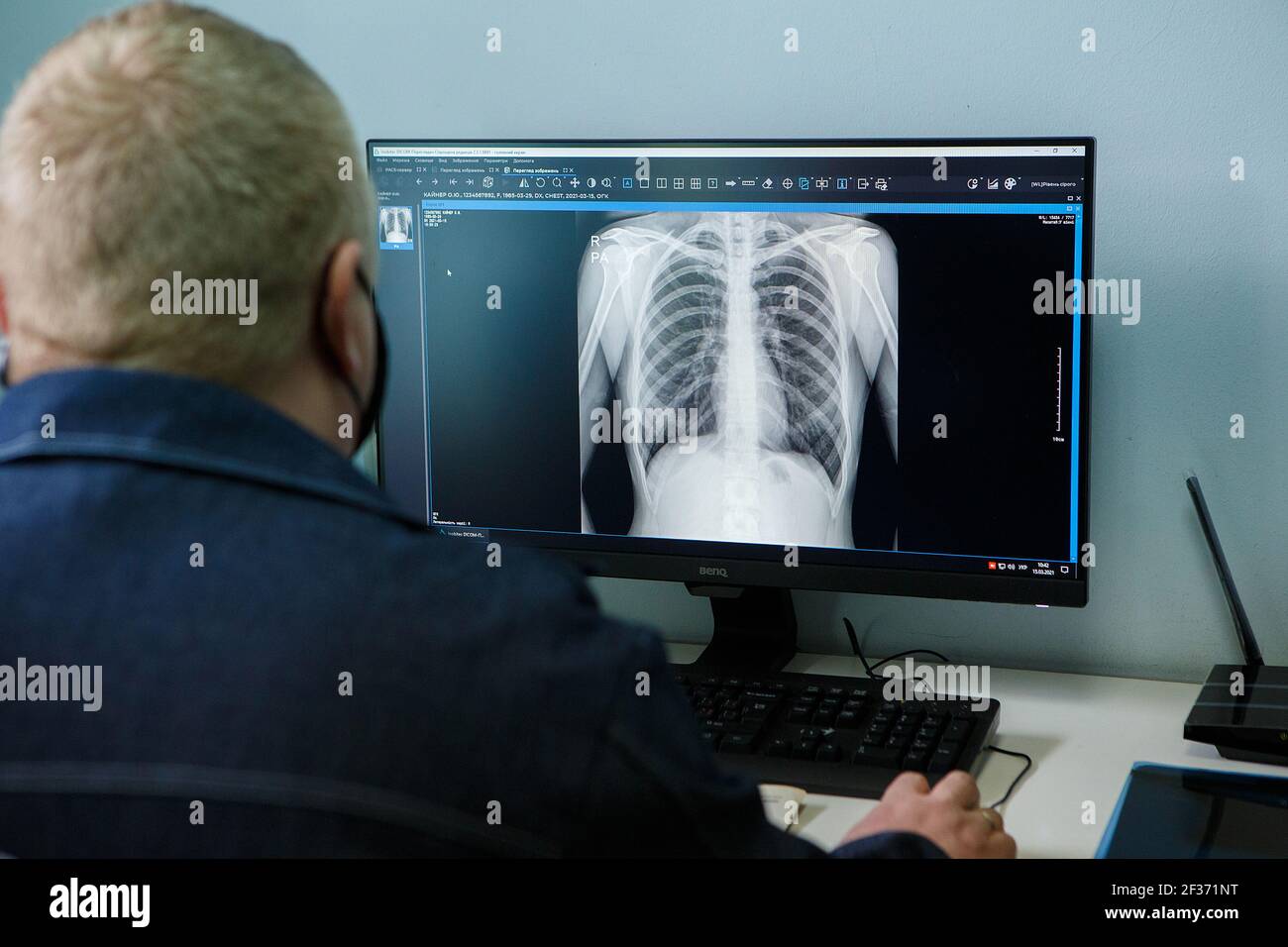 UZHHOROD, UCRAINA - 15 MARZO 2021 - i raggi X provenienti da un ufficio diagnostico radiologico digitale mobile vengono inviati al Centro di malattie polmonari PNC MPA tramite il Foto Stock