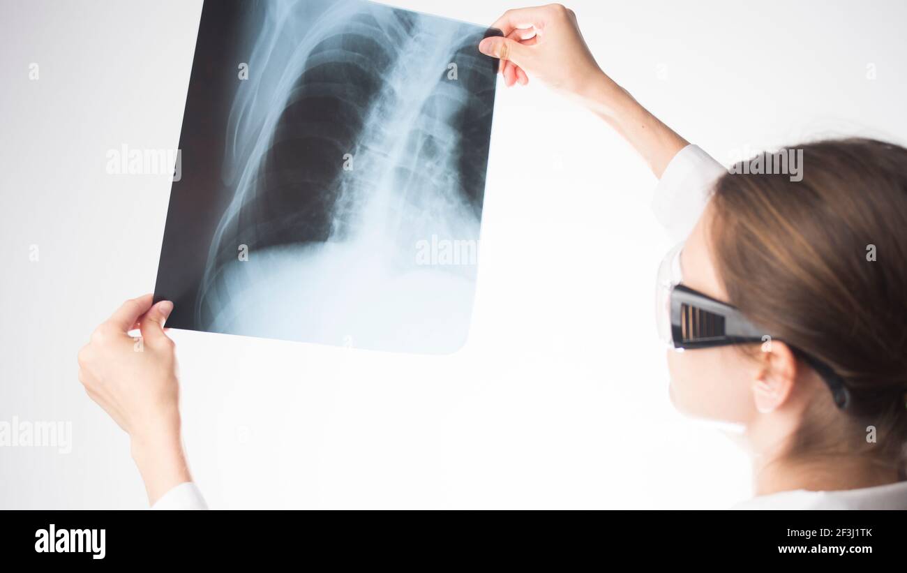Radiografia del torace con un medico Foto Stock