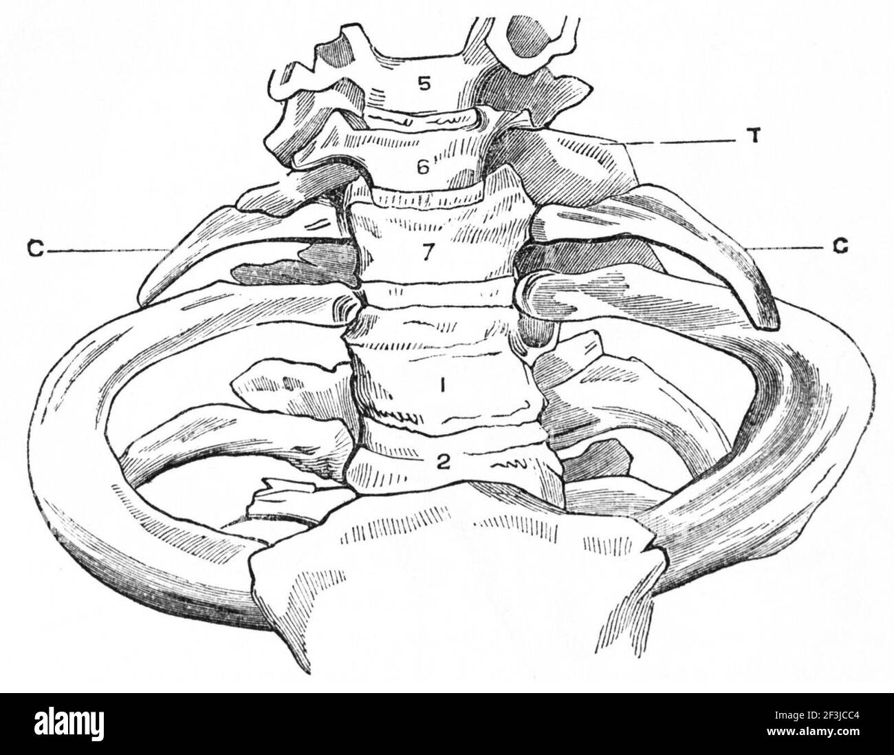 Costole cervicali e processo trasversale della vertebra cervicale. Foto Stock