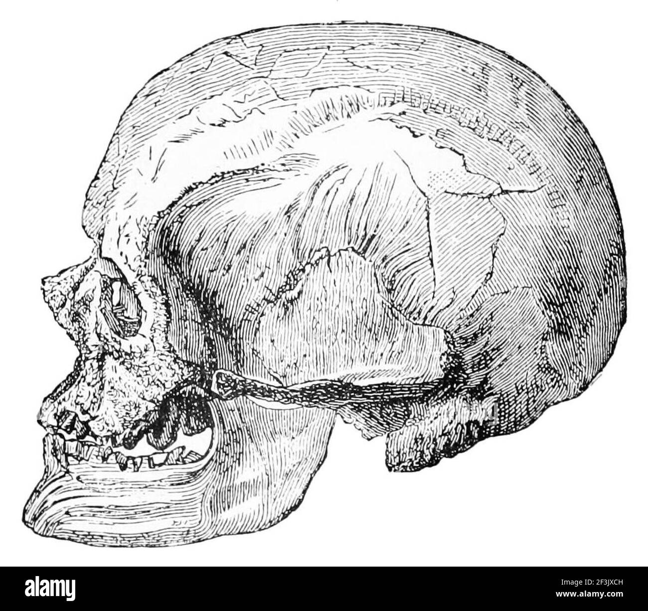 Cranio di un vecchio magnon di un velcro di les eyzies. Foto Stock
