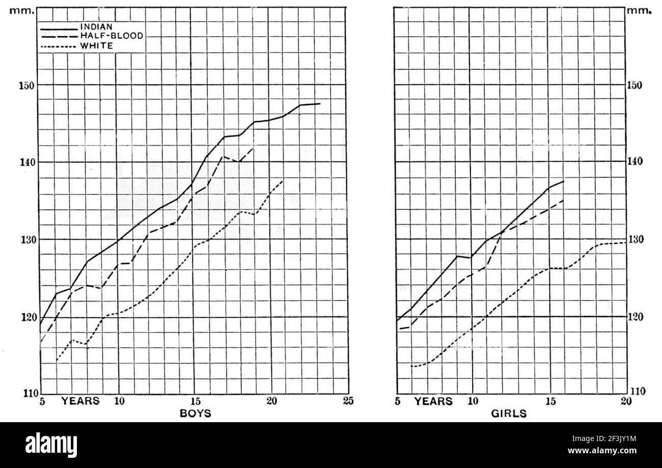 Ampiezza del volto di sangue misto indiano e bambini bianchi. Foto Stock